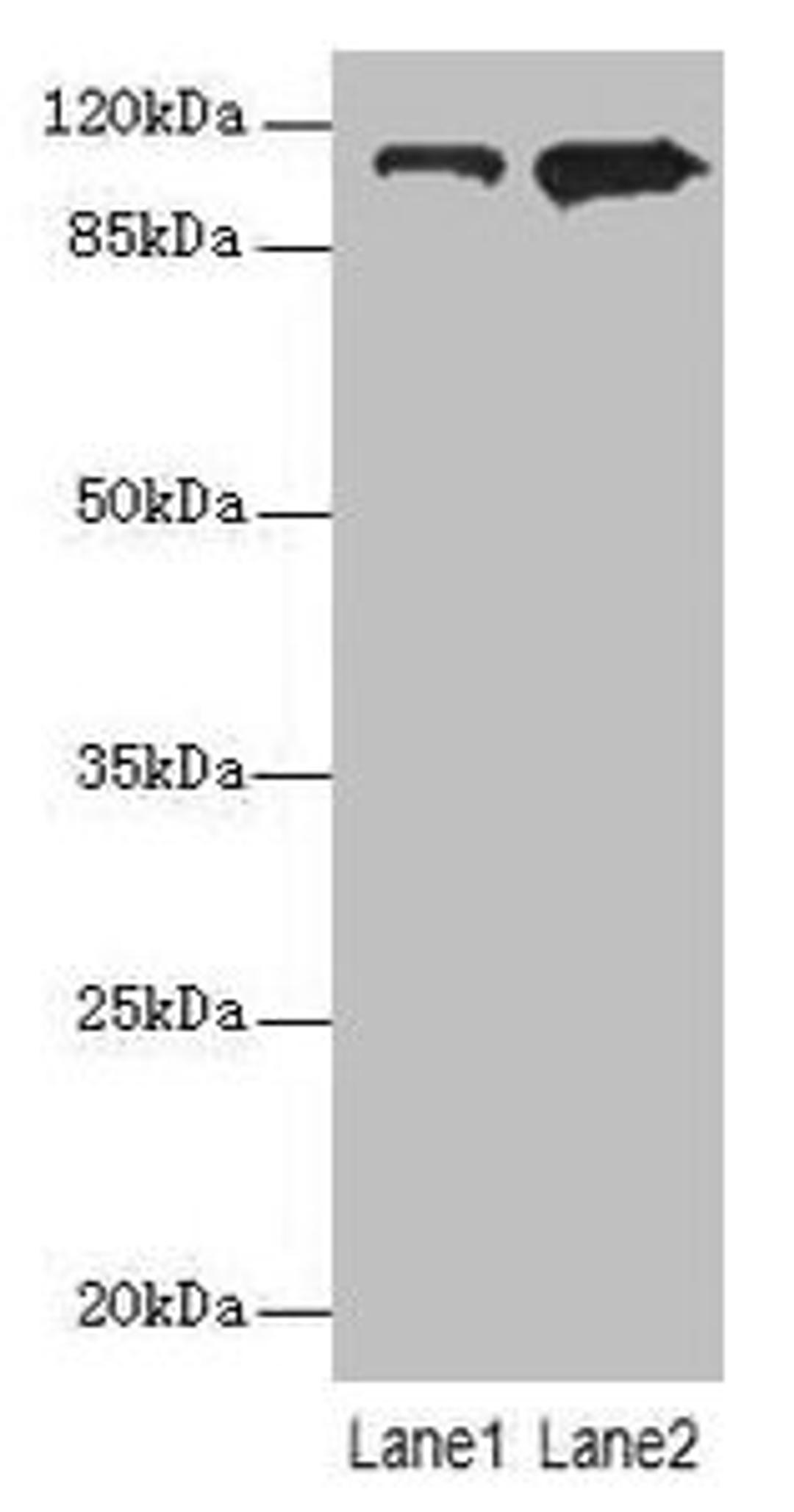 Western blot. All lanes: MOV10 antibody at 0.4µg/ml. Lane 1: HepG2 whole cell lysate. Lane 2: 293T whole cell lysate. Secondary. Goat polyclonal to rabbit IgG at 1/10000 dilution. Predicted band size: 114, 102, 7 kDa. Observed band size: 114 kDa