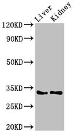 Western Blot. Positive WB detected in: Rat liver tissue, Mouse kidney tissue. All lanes: HEXIM2 antibody at 3µg/ml. Secondary. Goat polyclonal to rabbit IgG at 1/50000 dilution. Predicted band size: 33 kDa. Observed band size: 33 kDa