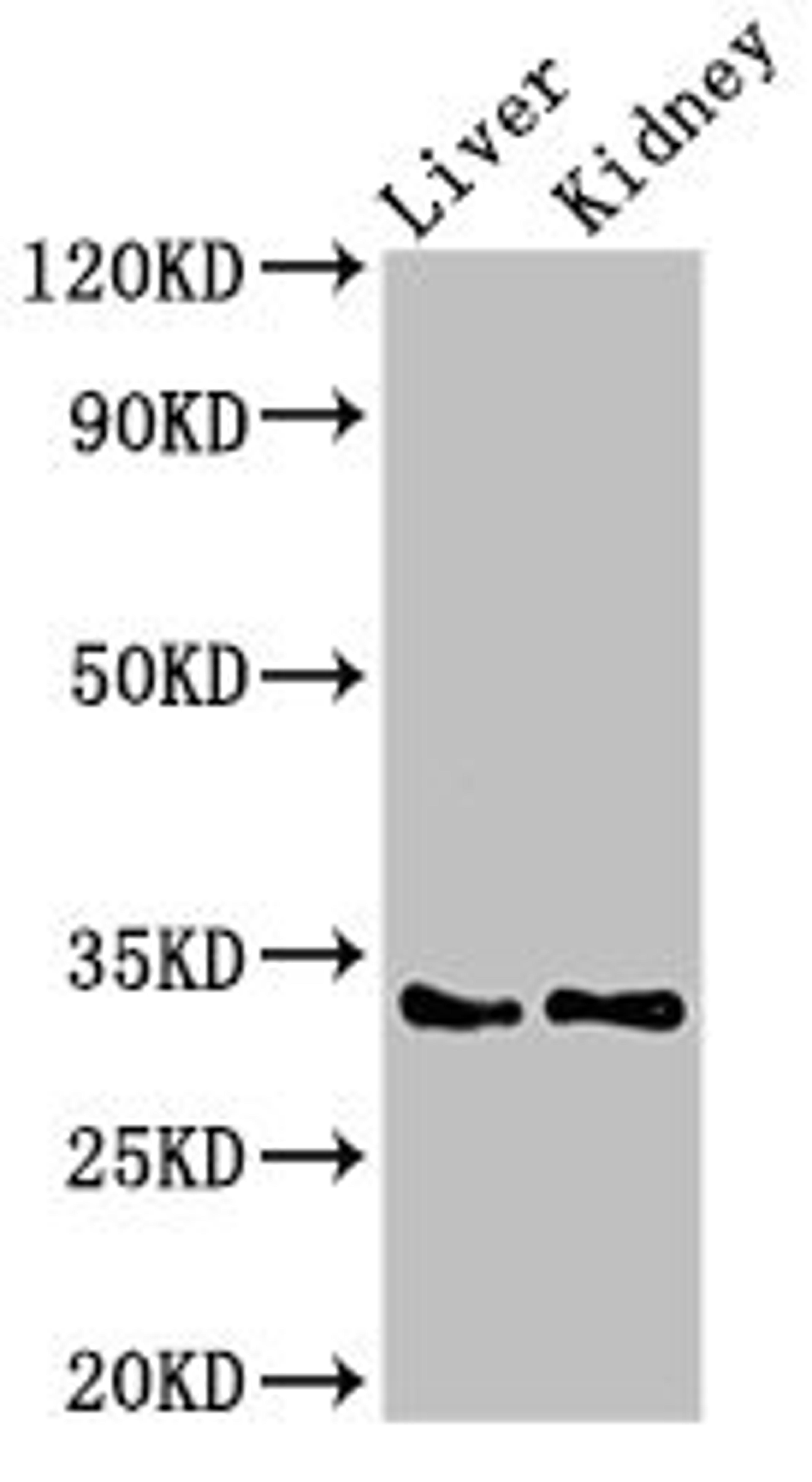 Western Blot. Positive WB detected in: Rat liver tissue, Mouse kidney tissue. All lanes: HEXIM2 antibody at 3µg/ml. Secondary. Goat polyclonal to rabbit IgG at 1/50000 dilution. Predicted band size: 33 kDa. Observed band size: 33 kDa