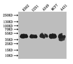 Western BlotPositive WB detected in: K562 whole cell lysate, U251 whole cell lysate, A549 whole cell lysate, MCF7 whole cell lysate, A431 whole cell lysateAll lanes: VPS26B antibody at 1:1000SecondaryGoat polyclonal to rabbit IgG at 1/50000 dilutionPredicted band size: 39 kDaObserved band size: 39 kDa