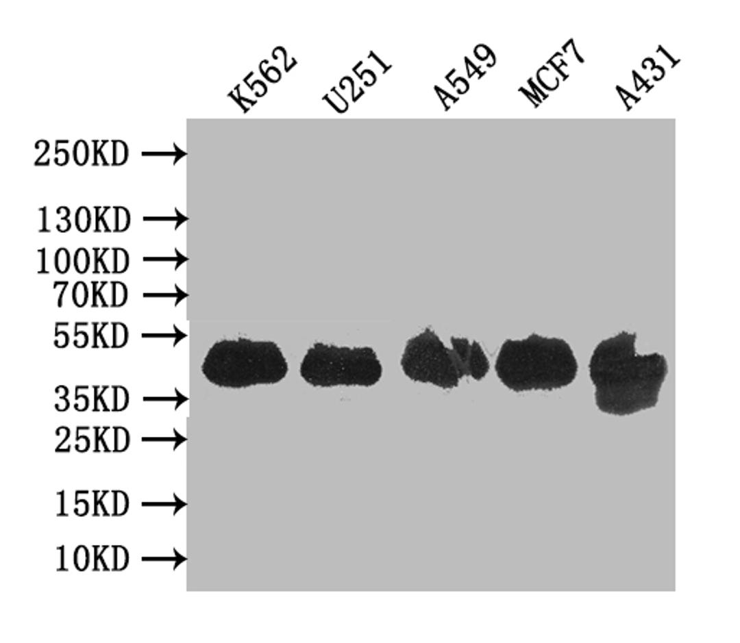 Western BlotPositive WB detected in: K562 whole cell lysate, U251 whole cell lysate, A549 whole cell lysate, MCF7 whole cell lysate, A431 whole cell lysateAll lanes: VPS26B antibody at 1:1000SecondaryGoat polyclonal to rabbit IgG at 1/50000 dilutionPredicted band size: 39 kDaObserved band size: 39 kDa