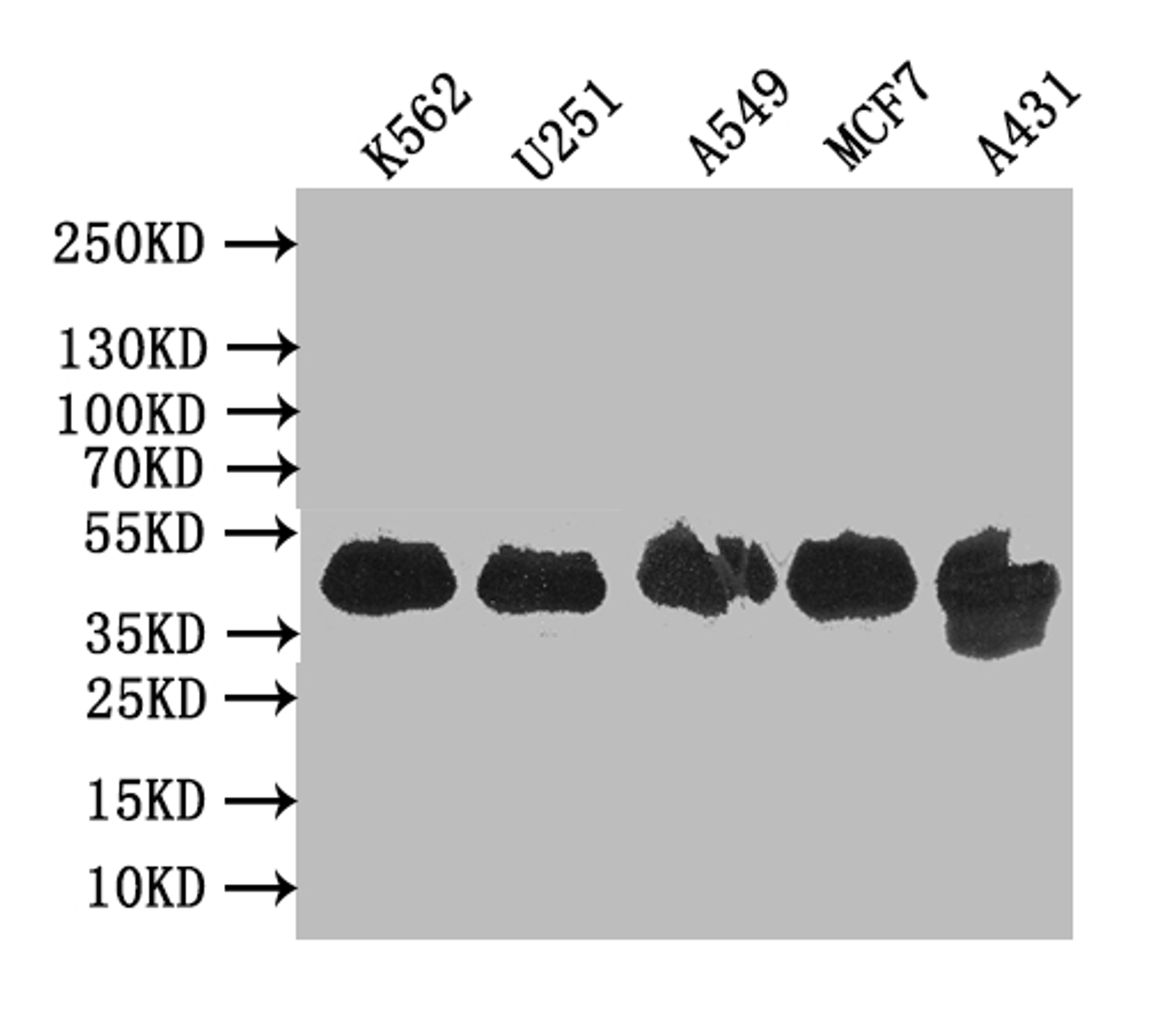 Western BlotPositive WB detected in: K562 whole cell lysate, U251 whole cell lysate, A549 whole cell lysate, MCF7 whole cell lysate, A431 whole cell lysateAll lanes: VPS26B antibody at 1:1000SecondaryGoat polyclonal to rabbit IgG at 1/50000 dilutionPredicted band size: 39 kDaObserved band size: 39 kDa