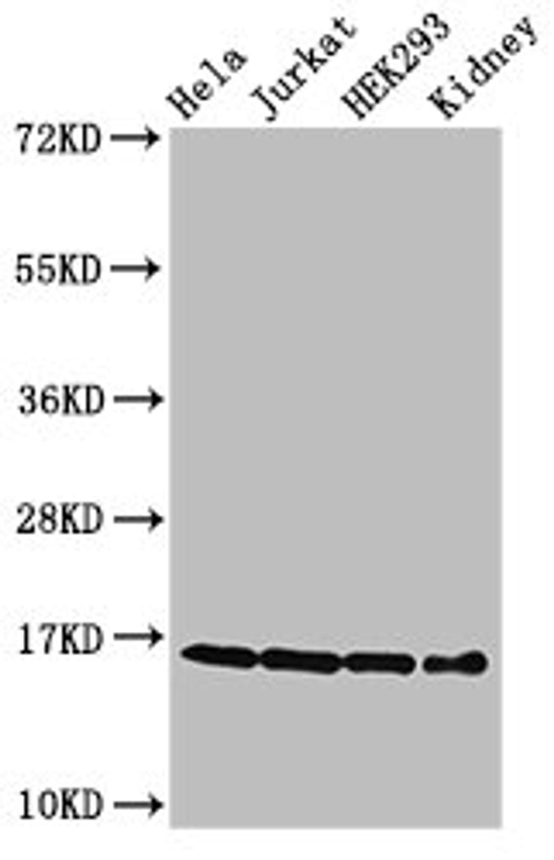 Western Blot. Positive WB detected in: Hela cell acid extracts, Jurkat cell acid extracts, HEK293 cell acid extracts, Mouse kidney tissue. All lanes: HIST1H3A antibody at 0.3µg/ml. Secondary. Goat polyclonal to rabbit IgG at 1/50000 dilution. Predicted band size: 16 kDa. Observed band size: 16 kDa