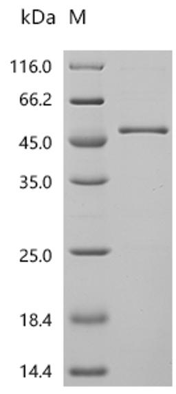 (Tris-Glycine gel) Discontinuous SDS-PAGE (reduced) with 5% enrichment gel and 15% separation gel.