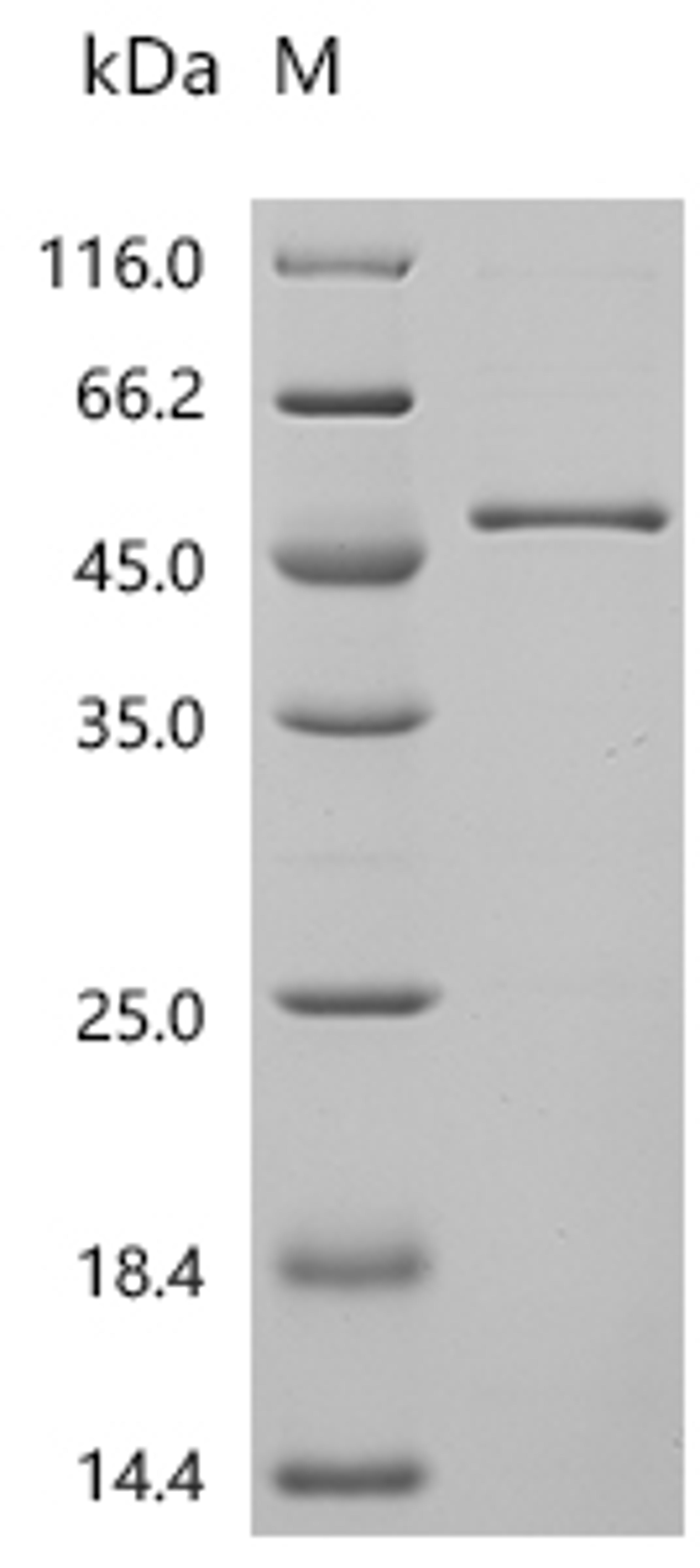(Tris-Glycine gel) Discontinuous SDS-PAGE (reduced) with 5% enrichment gel and 15% separation gel.