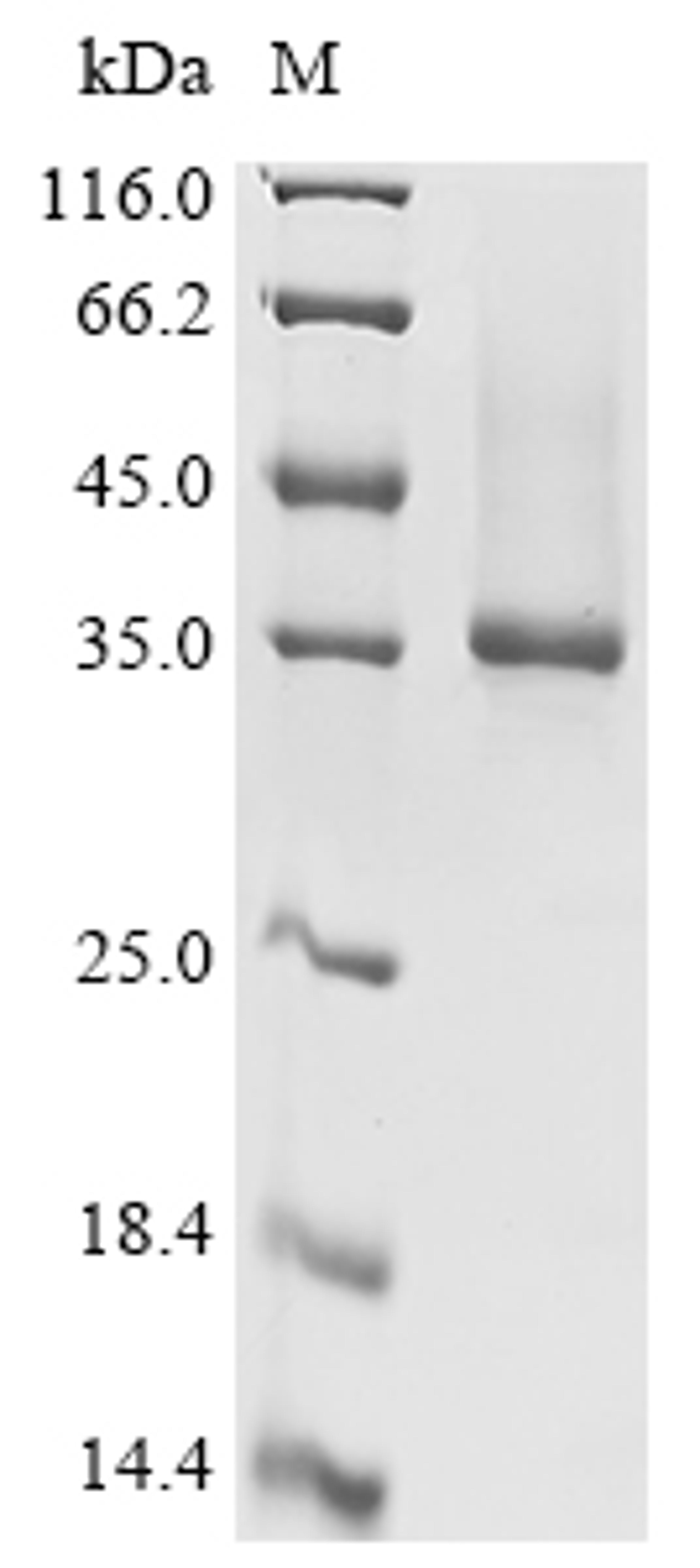 (Tris-Glycine gel) Discontinuous SDS-PAGE (reduced) with 5% enrichment gel and 15% separation gel.