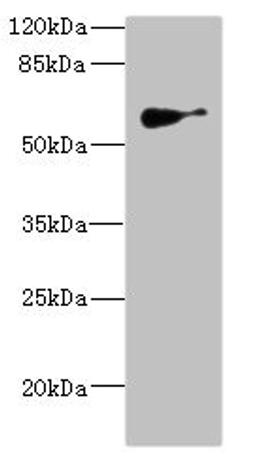 Western blot. All lanes: SLC22A8antibody IgG at 1.62ug/ml + Mouse kidney tissue. Secondary. Goat polyclonal to rabbit IgG at 1/10000 dilution. Predicted band size: 60, 61, 47, 12, 50 kDa. Observed band size: 60 kDa. 