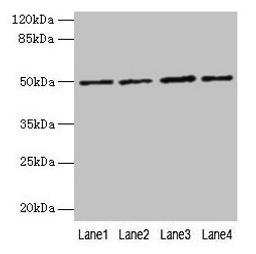 Western blot. All lanes: EVA1C antibody at 5µg/ml. Lane 1: Hela whole cell lysate. Lane 2: Jurkat whole cell lysate. Lane 3: 293T whole cell lysate. Lane 4: HL60 whole cell lysate. Secondary. Goat polyclonal to rabbit IgG at 1/10000 dilution. Predicted band size: 50, 8 kDa. Observed band size: 50 kDa