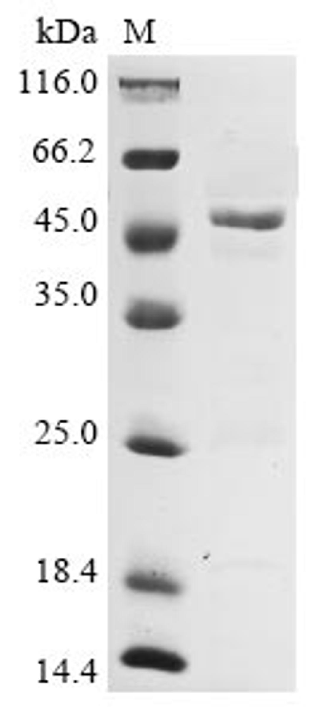 (Tris-Glycine gel) Discontinuous SDS-PAGE (reduced) with 5% enrichment gel and 15% separation gel.