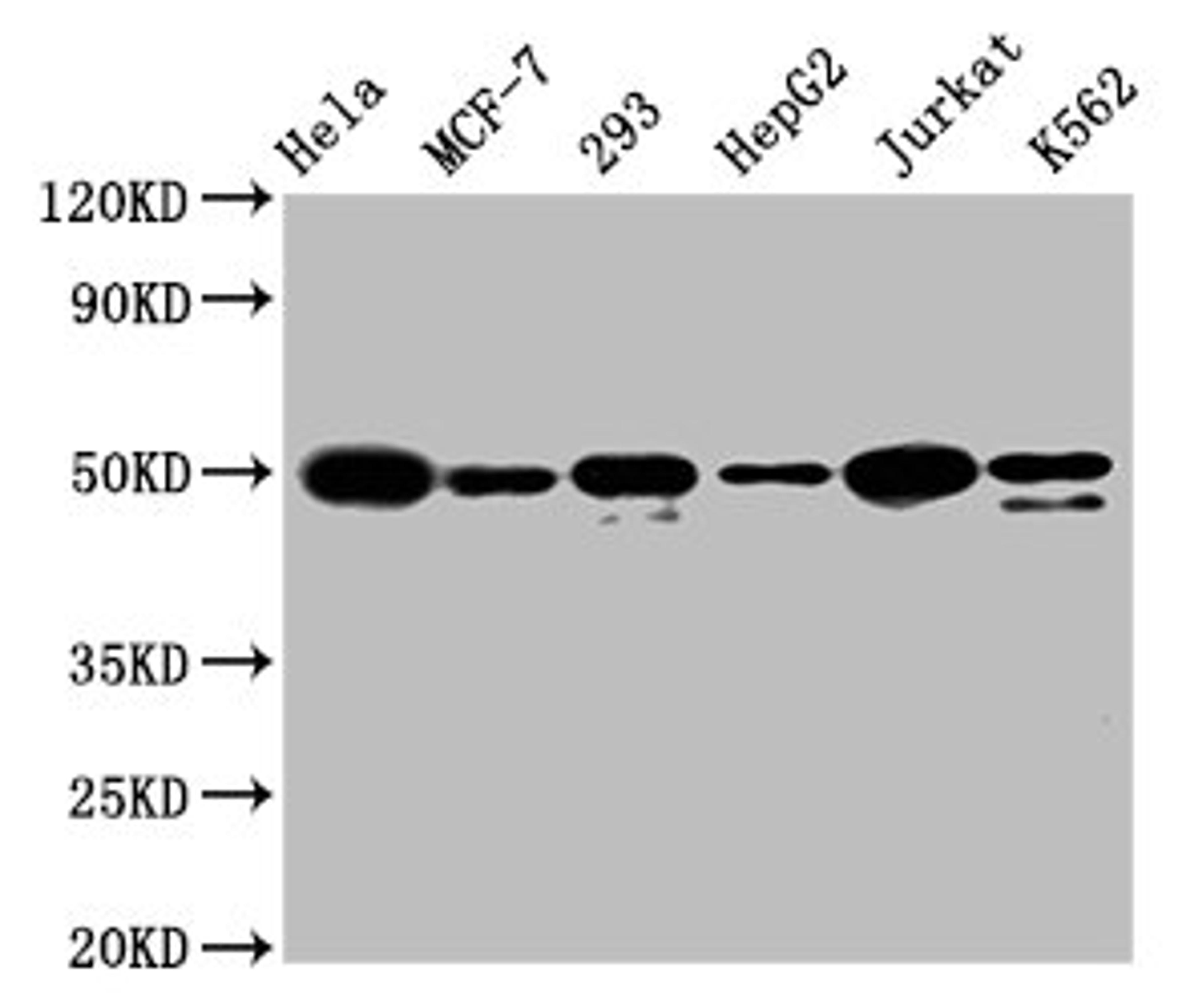 Western Blot. Positive WB detected in: Hela whole cell lysate, MCF-7 whole cell lysate, 293 whole cell lysate, HepG2 whole cell lysate, Jurkat whole cell lysate, K562 whole cell lysate. All lanes: ATF4 antibody at 1.6μg/ml. Secondary. Goat polyclonal to rabbit IgG at 1/50000 dilution. Predicted band size: 39 KDa. Observed band size: 50 KDa.