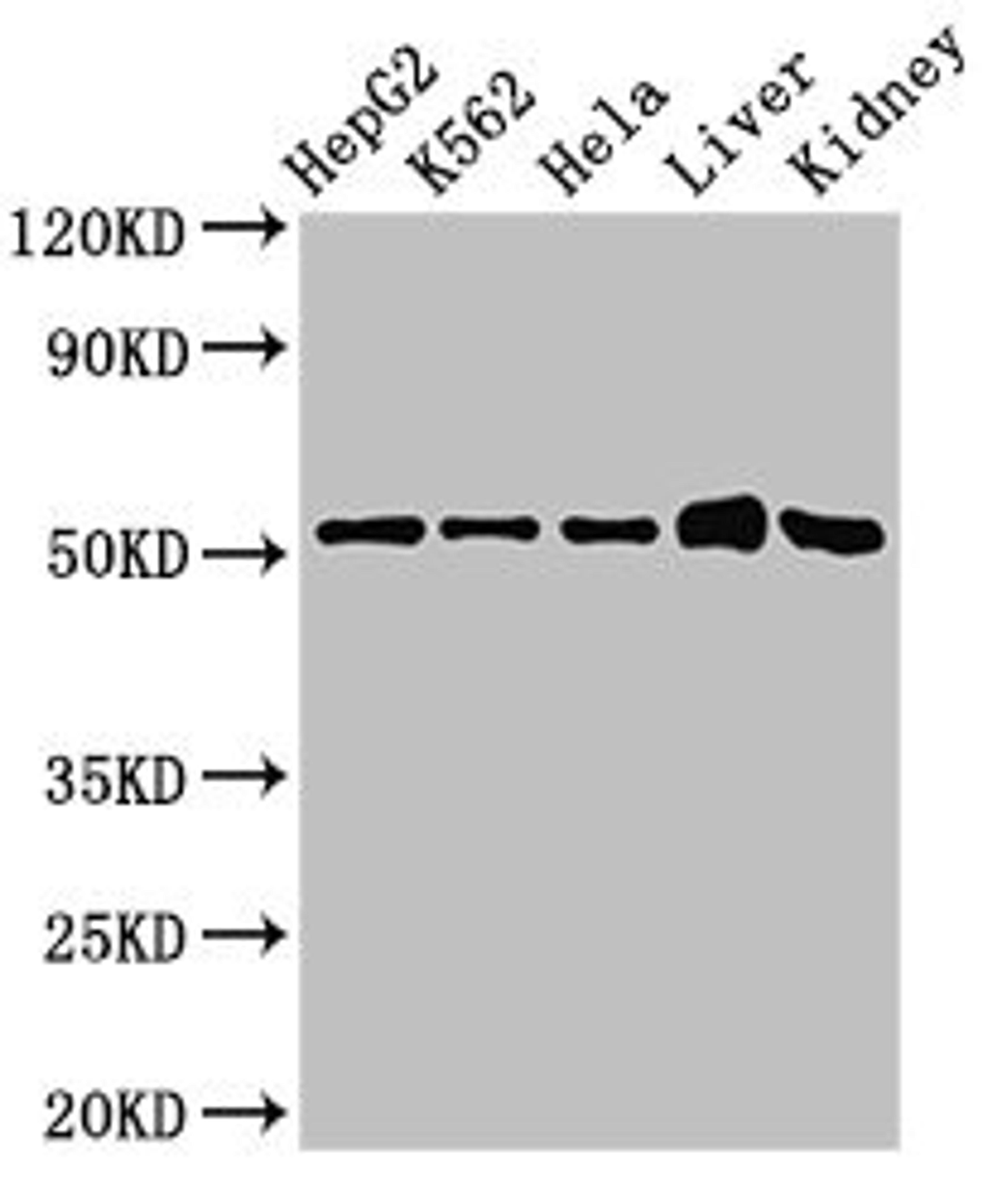 Western Blot. Positive WB detected in: HepG2 whole cell lysate, K562 whole cell lysate, Hela whole cell lysate, Mouse liver tissue, Mouse kidney tissue. All lanes: FBXW2 antibody at 3ug/ml. Secondary. Goat polyclonal to rabbit IgG at 1/50000 dilution. Predicted band size: 52, 45 kDa. Observed band size: 52 kDa.