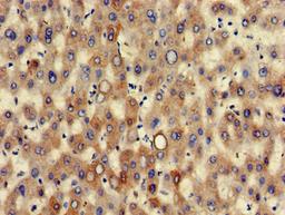Immunohistochemistry of paraffin-embedded human liver tissue using CSB-PA012564LA01HU at dilution of 1:100