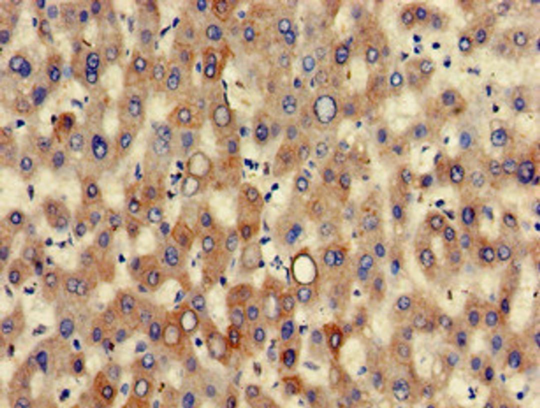 Immunohistochemistry of paraffin-embedded human liver tissue using CSB-PA012564LA01HU at dilution of 1:100