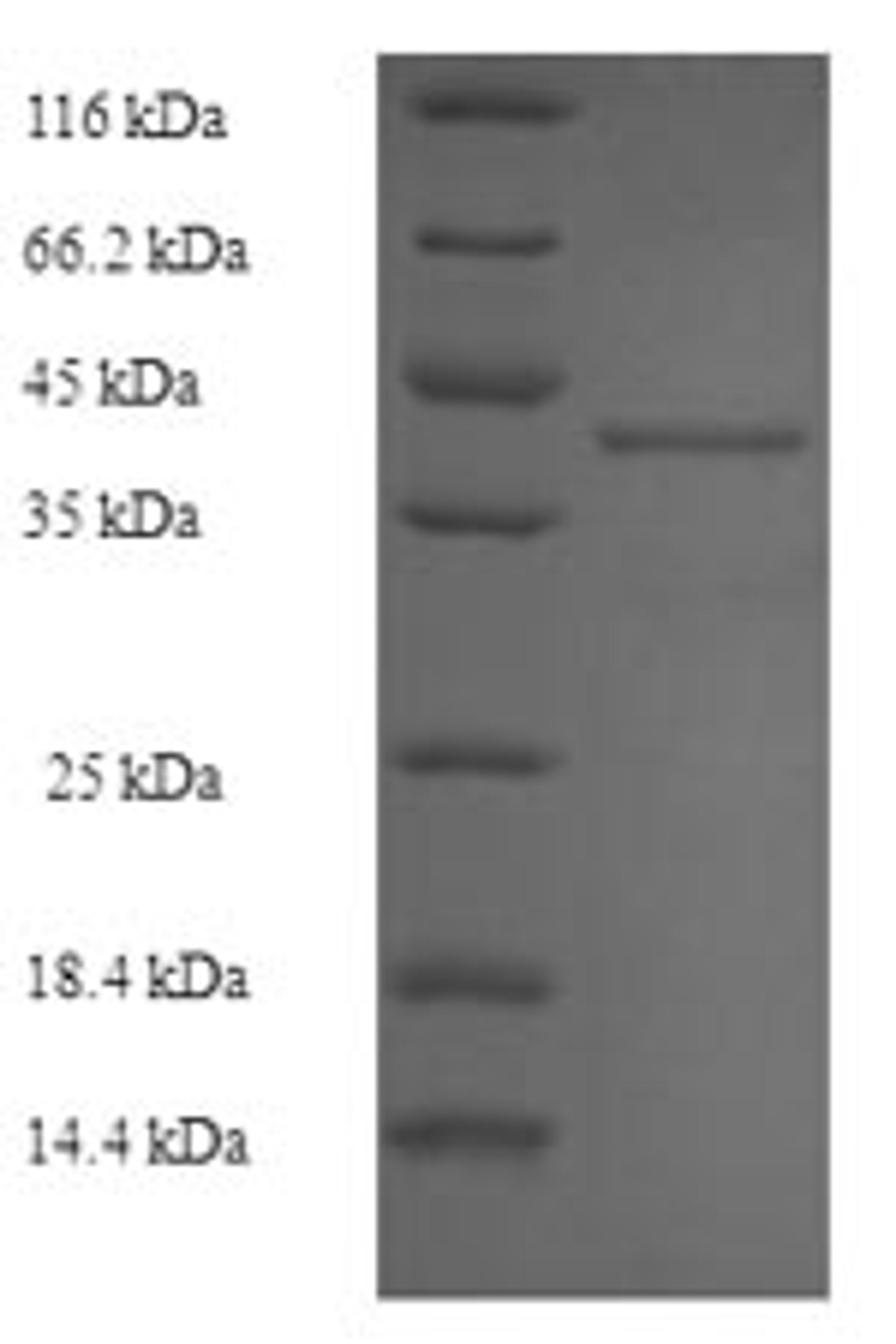(Tris-Glycine gel) Discontinuous SDS-PAGE (reduced) with 5% enrichment gel and 15% separation gel.