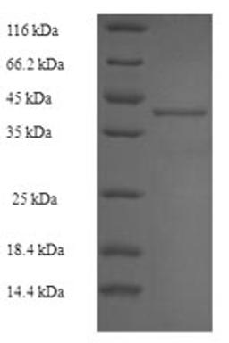 (Tris-Glycine gel) Discontinuous SDS-PAGE (reduced) with 5% enrichment gel and 15% separation gel.