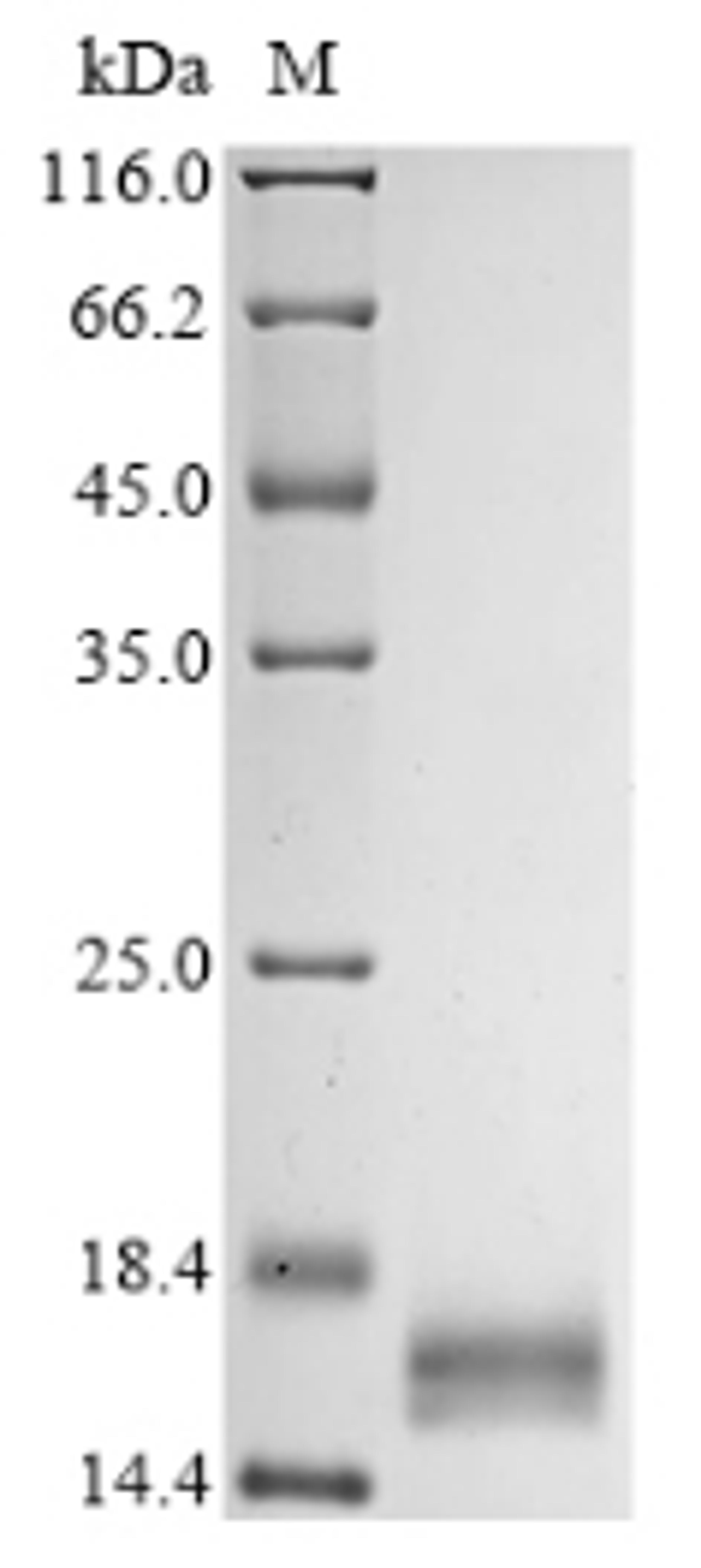 (Tris-Glycine gel) Discontinuous SDS-PAGE (reduced) with 5% enrichment gel and 15% separation gel.