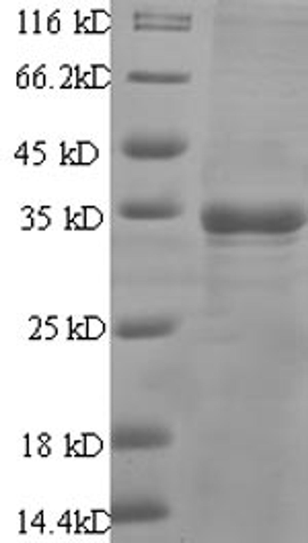 (Tris-Glycine gel) Discontinuous SDS-PAGE (reduced) with 5% enrichment gel and 15% separation gel.