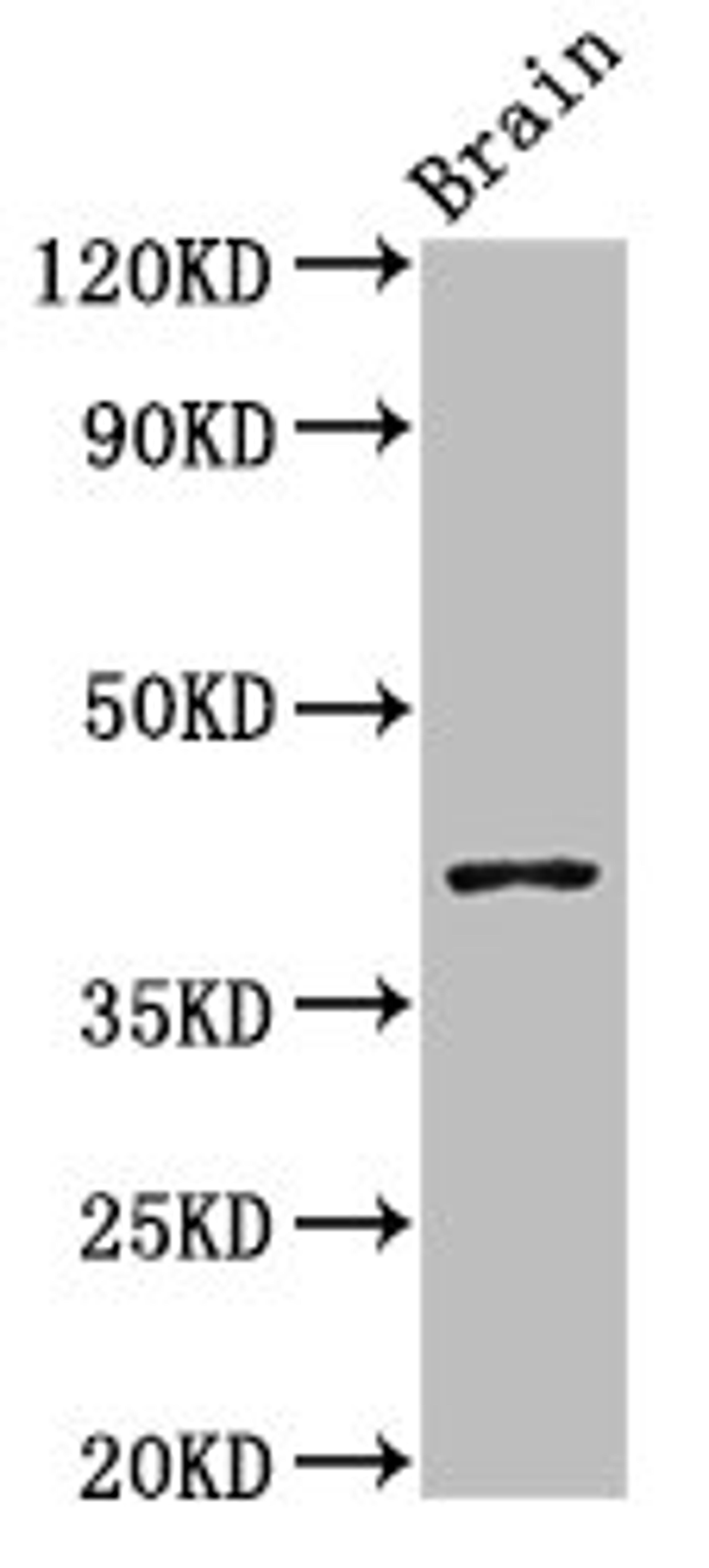 Western Blot. Positive WB detected in: Mouse brain tissue. All lanes: SEPT3 antibody at 3ug/ml. Secondary. Goat polyclonal to rabbit IgG at 1/50000 dilution. Predicted band size: 41, 10 kDa. Observed band size: 41 kDa. 