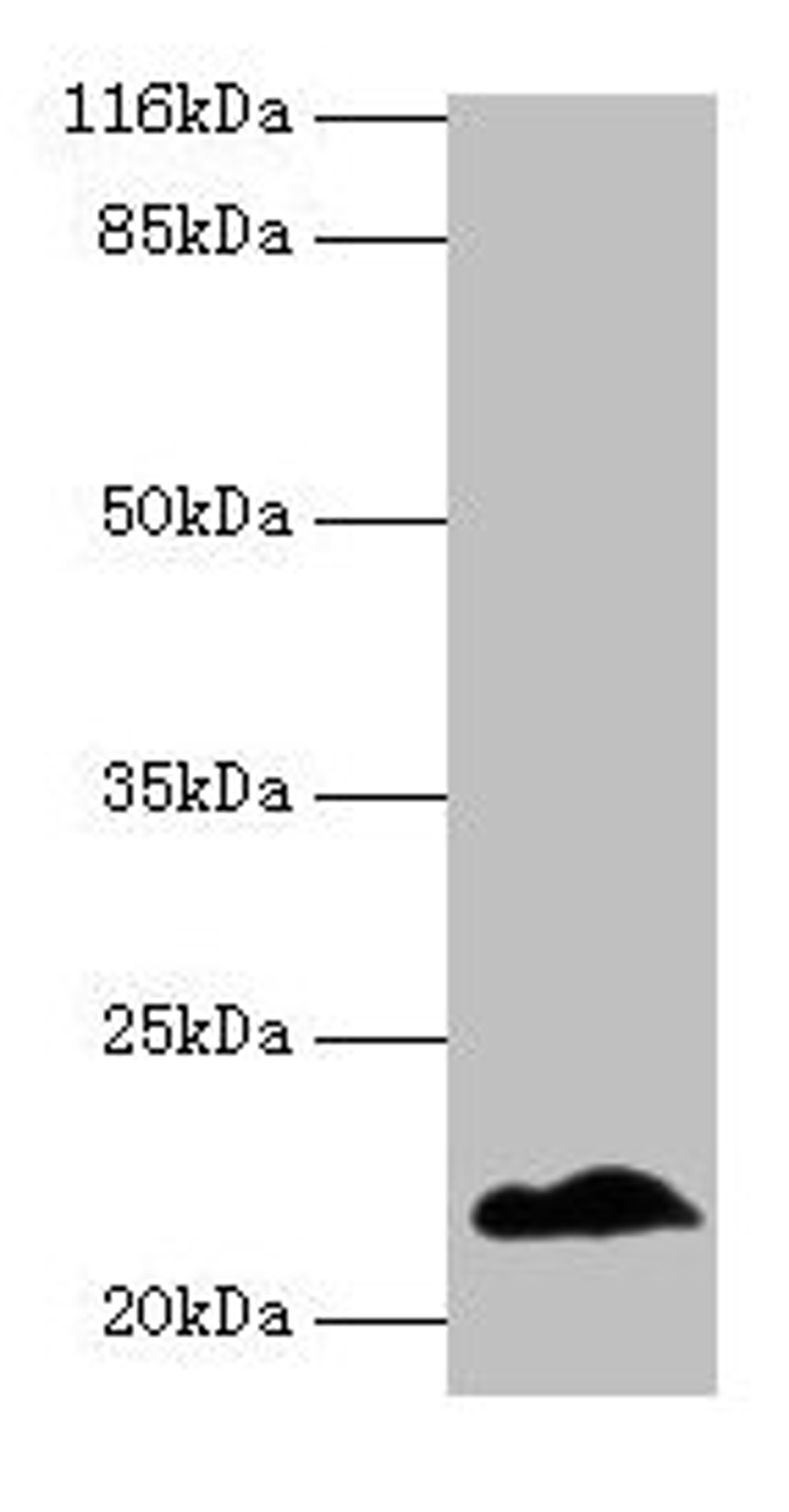 Western blot. All lanes: NDUFB5 antibody at 2µg/ml + U251 whole cell lysate. Secondary. Goat polyclonal to rabbit IgG at 1/10000 dilution. Predicted band size: 22, 16 kDa. Observed band size: 22 kDa