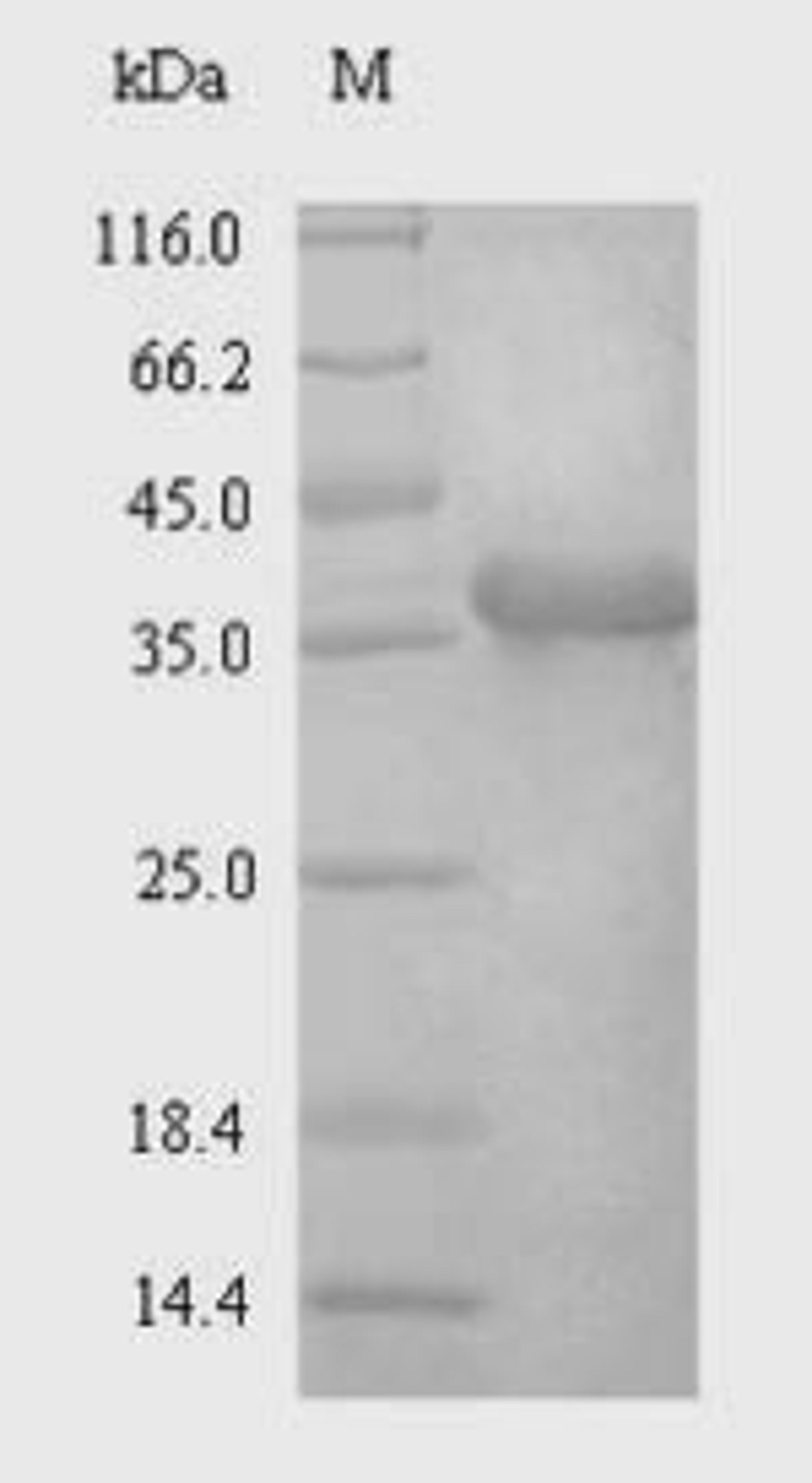 (Tris-Glycine gel) Discontinuous SDS-PAGE (reduced) with 5% enrichment gel and 15% separation gel.