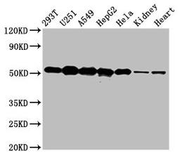 Western Blot. Positive WB detected in: 293T whole cell lysate, U251 whole cell lysate, A549 whole cell lysate, HepG2 whole cell lysate, Hela whole cell lysate, Rat kidney tissue, Mouse heart tissue. All lanes: SLC25A24 antibody at 5µg/ml. Secondary. Goat polyclonal to rabbit IgG at 1/50000 dilution. Predicted band size: 54, 52 kDa. Observed band size: 54 kDa