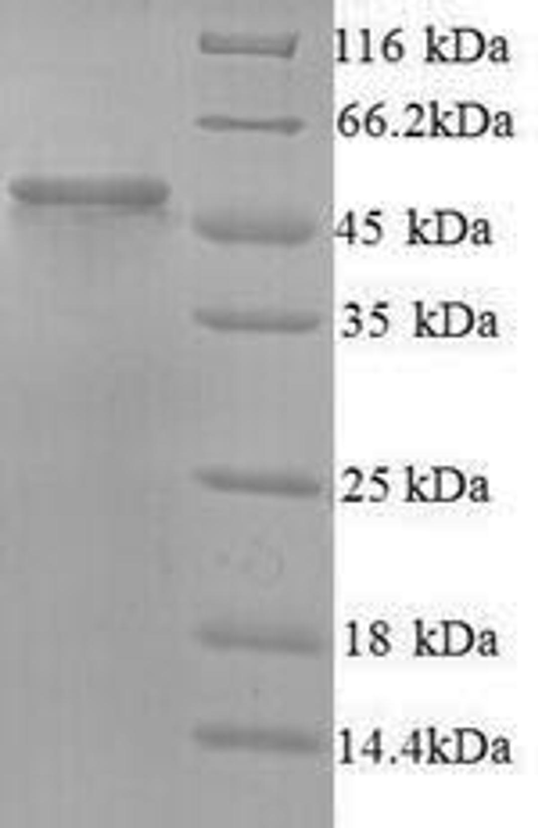 (Tris-Glycine gel) Discontinuous SDS-PAGE (reduced) with 5% enrichment gel and 15% separation gel.
