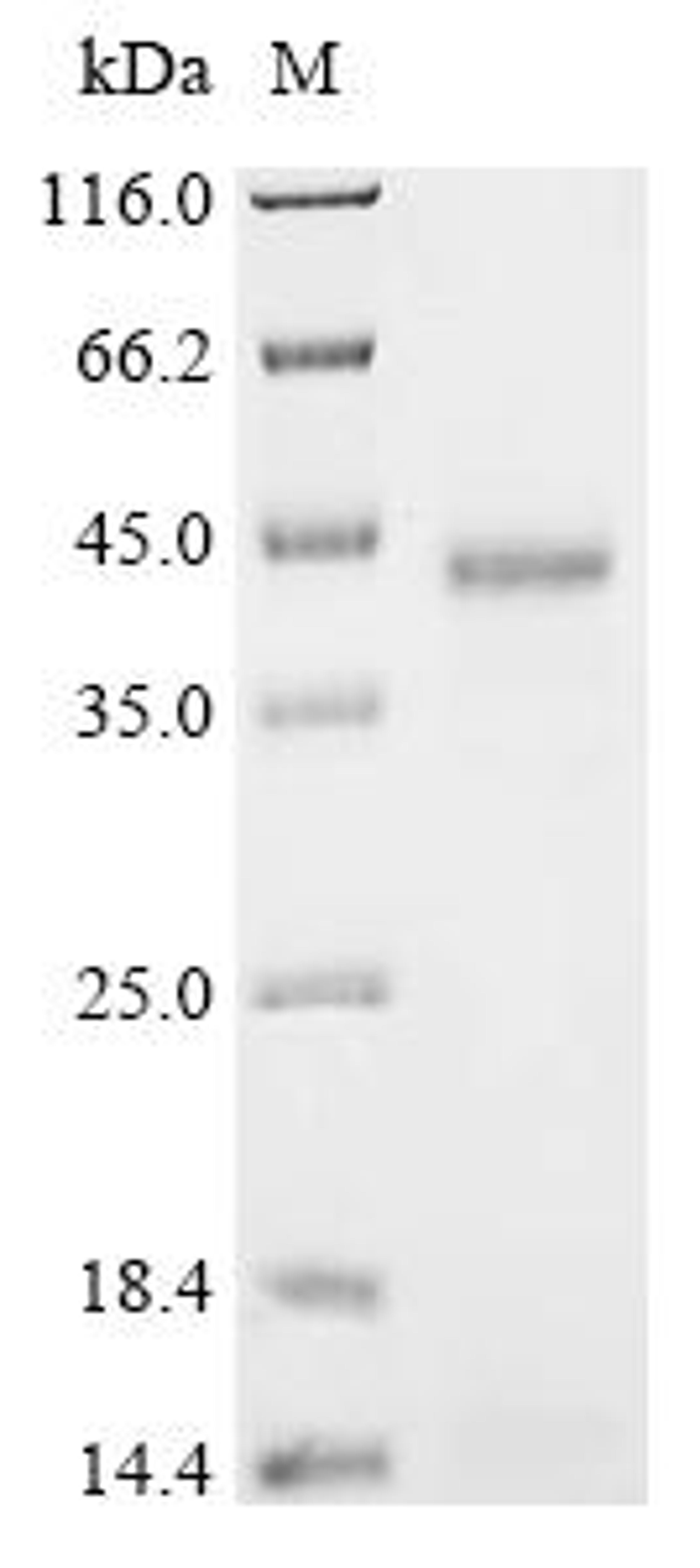 (Tris-Glycine gel) Discontinuous SDS-PAGE (reduced) with 5% enrichment gel and 15% separation gel.