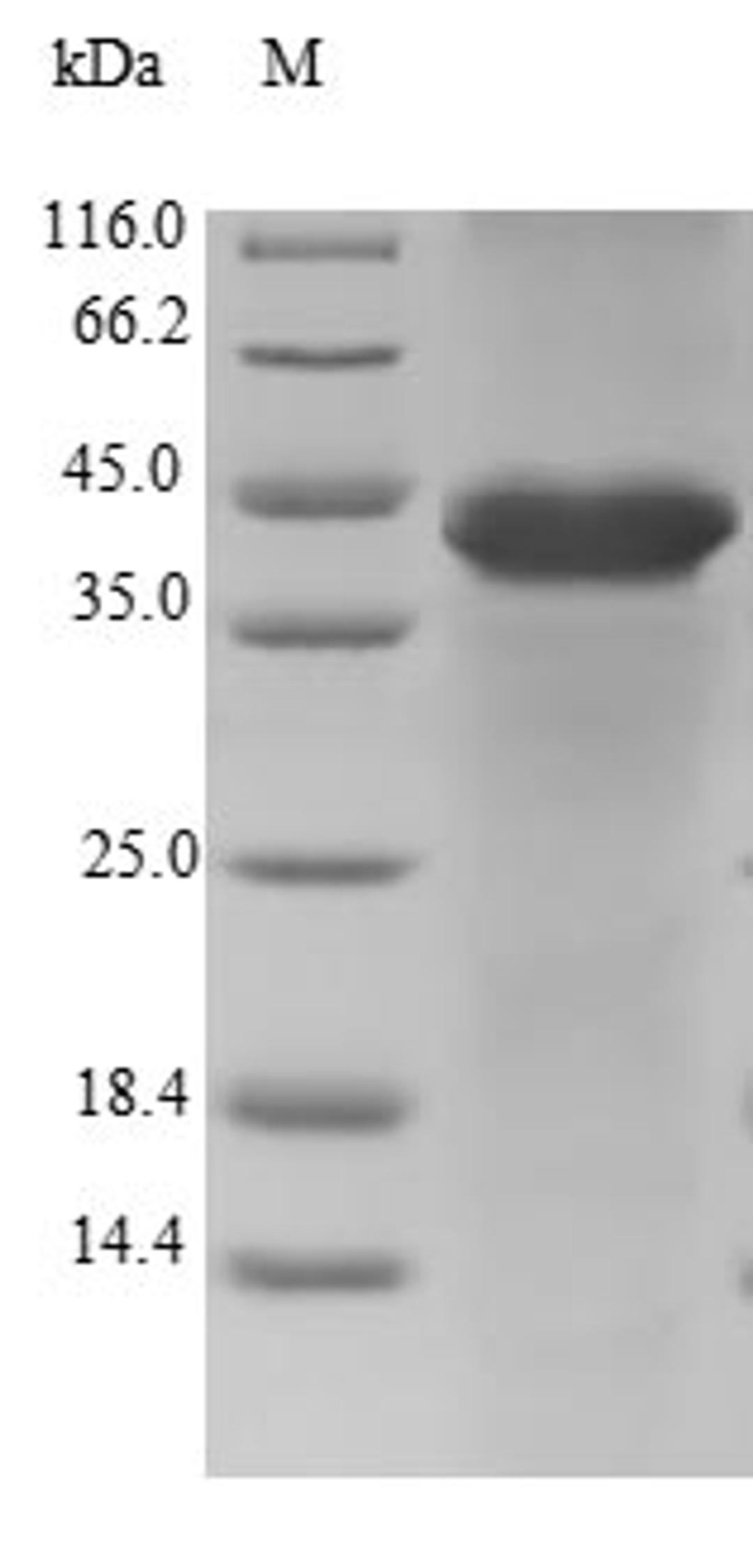 (Tris-Glycine gel) Discontinuous SDS-PAGE (reduced) with 5% enrichment gel and 15% separation gel.