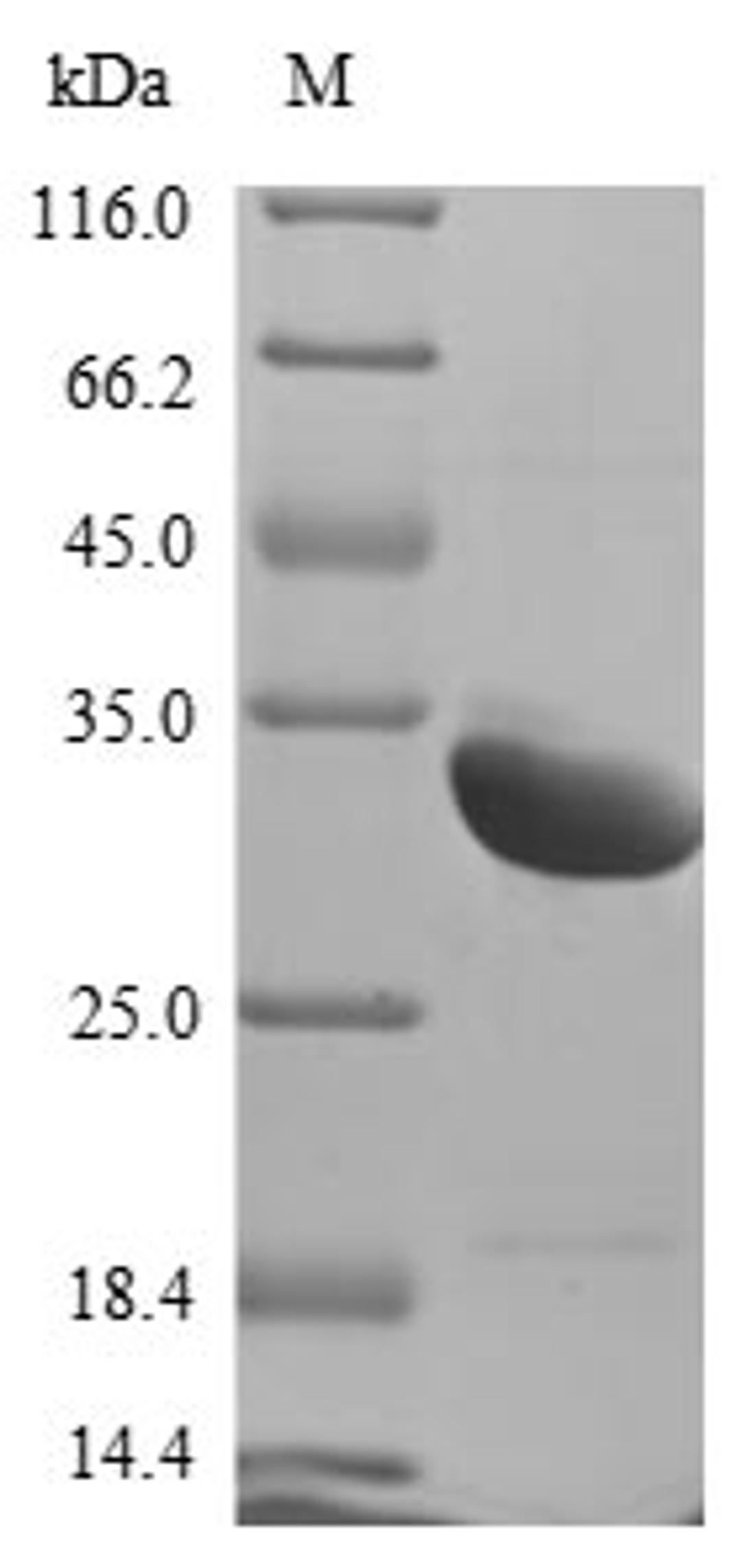 (Tris-Glycine gel) Discontinuous SDS-PAGE (reduced) with 5% enrichment gel and 15% separation gel.