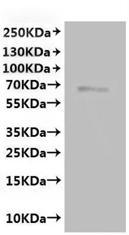 CSB-MP852782MO is detected by Mouse anti-6*His monoclonal antibody.