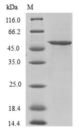 (Tris-Glycine gel) Discontinuous SDS-PAGE (reduced) with 5% enrichment gel and 15% separation gel.