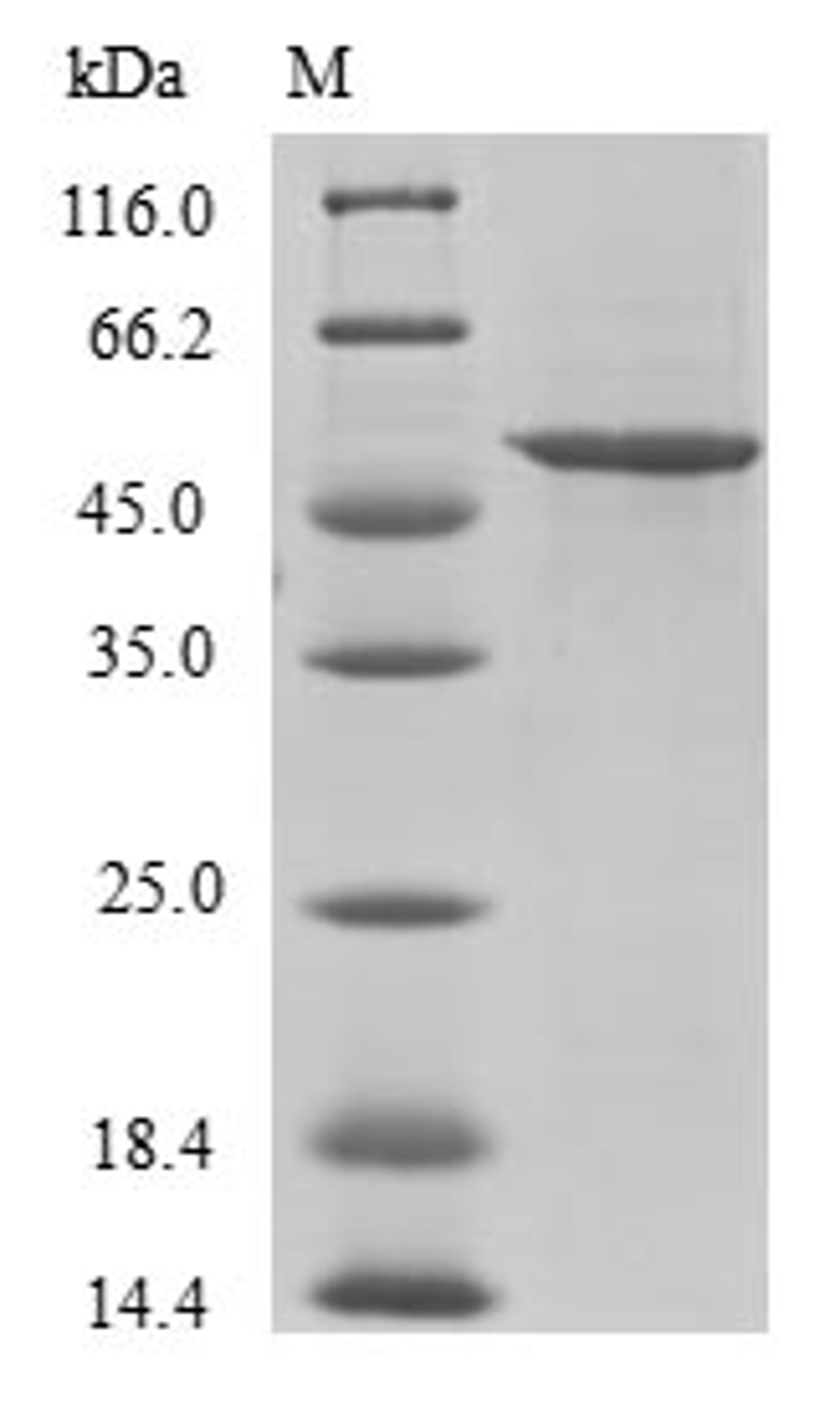 (Tris-Glycine gel) Discontinuous SDS-PAGE (reduced) with 5% enrichment gel and 15% separation gel.