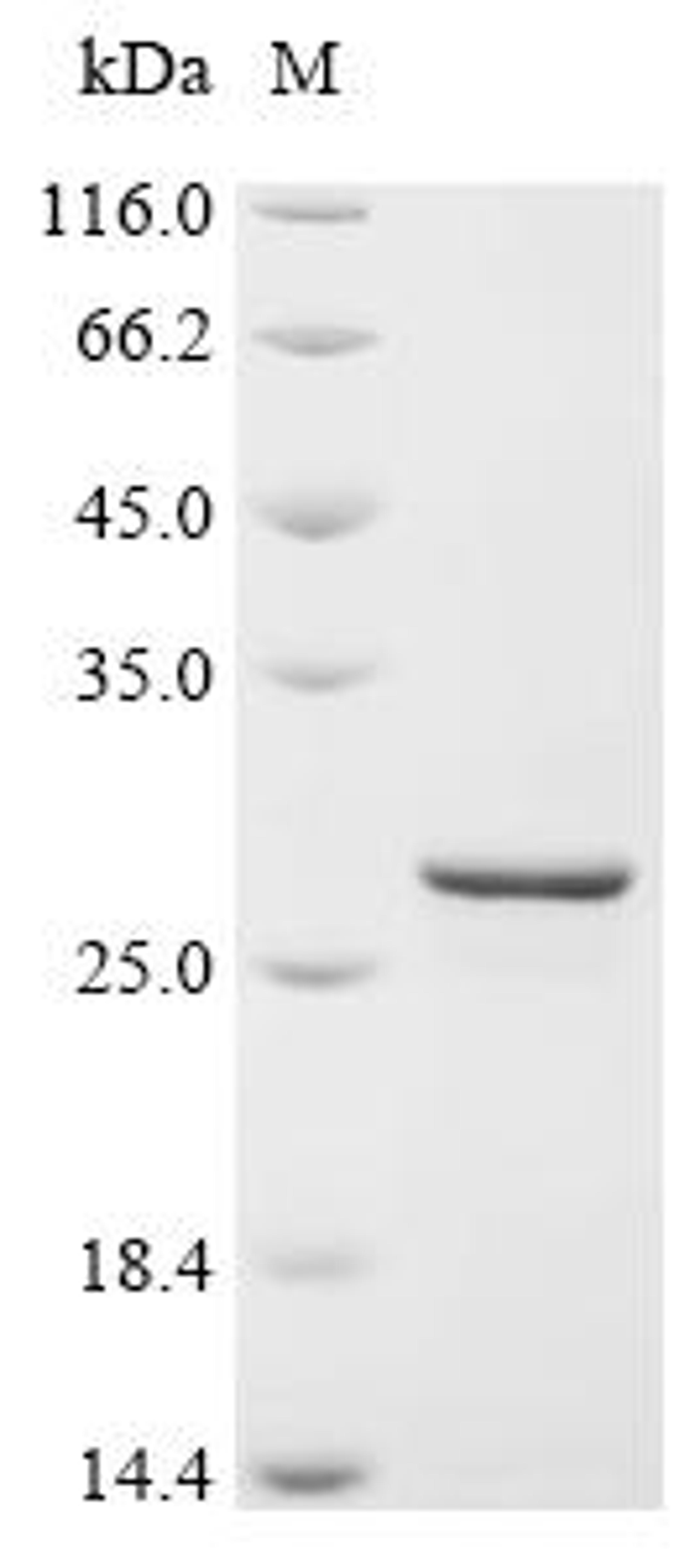 (Tris-Glycine gel) Discontinuous SDS-PAGE (reduced) with 5% enrichment gel and 15% separation gel.