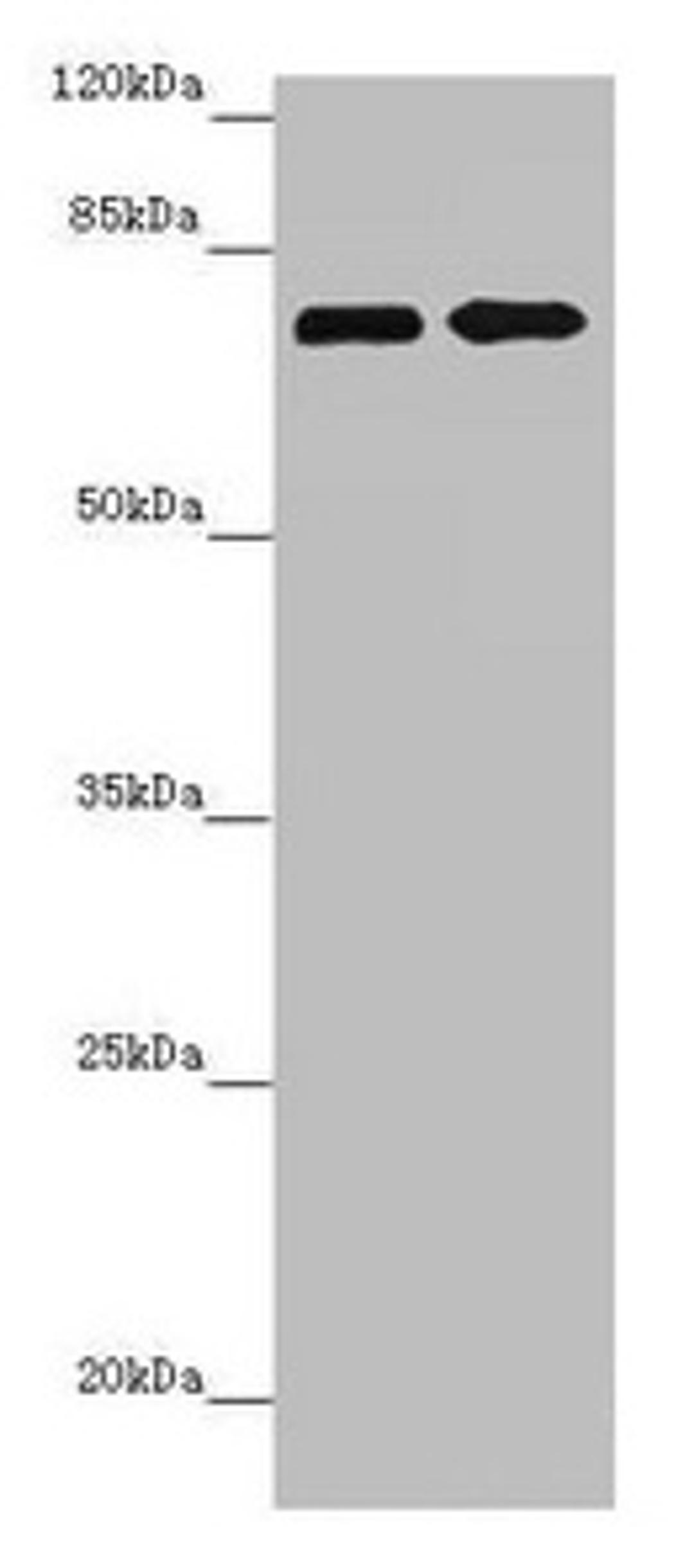 Western blot. All lanes: ZNF264 antibody at 2.07µg/ml. Lane 1: Jurkat whole cell lysate. Lane 2: 293T whole cell lysate. Secondary. Goat polyclonal to rabbit IgG at 1/10000 dilution. Predicted band size: 71 kDa. Observed band size: 71 kDa