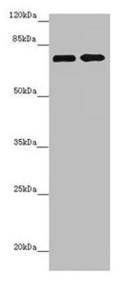 Western blot. All lanes: ZNF264 antibody at 2.07µg/ml. Lane 1: Jurkat whole cell lysate. Lane 2: 293T whole cell lysate. Secondary. Goat polyclonal to rabbit IgG at 1/10000 dilution. Predicted band size: 71 kDa. Observed band size: 71 kDa