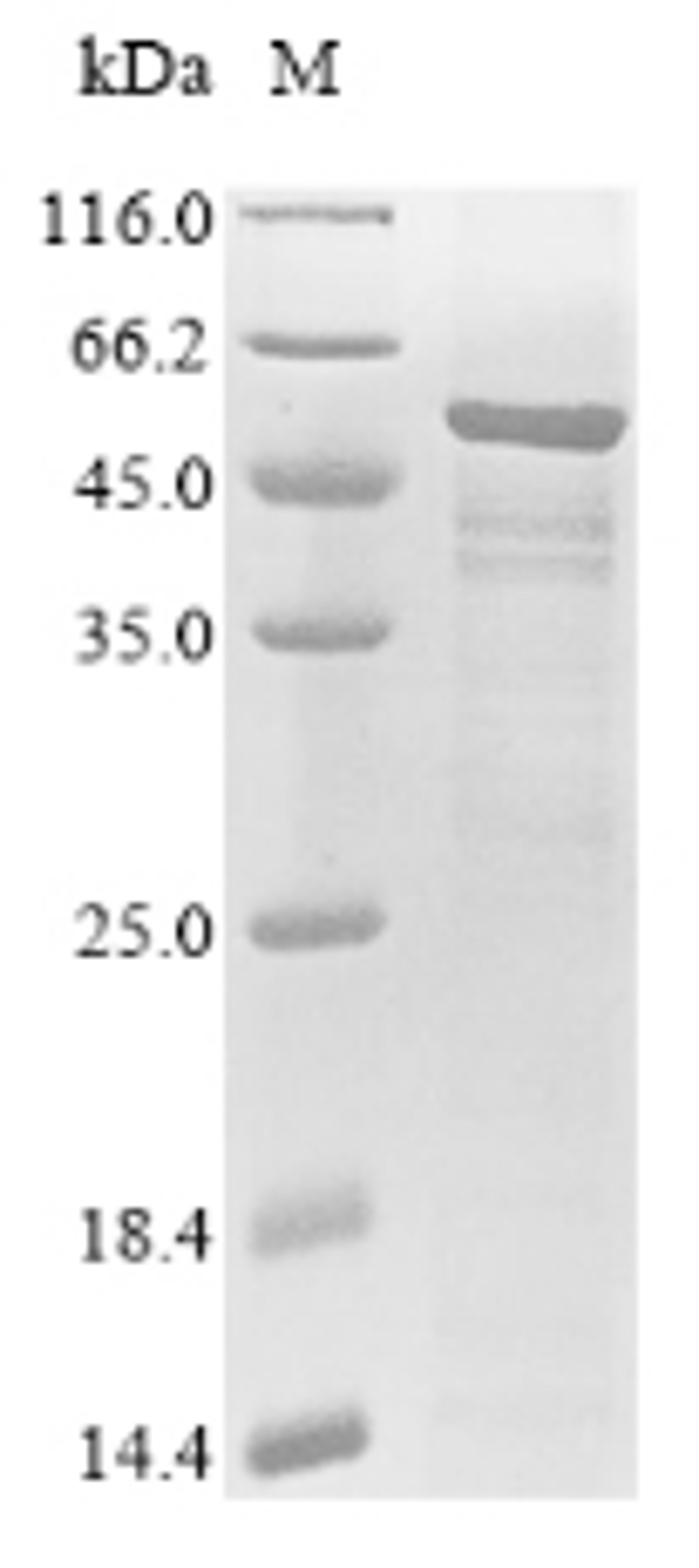 (Tris-Glycine gel) Discontinuous SDS-PAGE (reduced) with 5% enrichment gel and 15% separation gel.