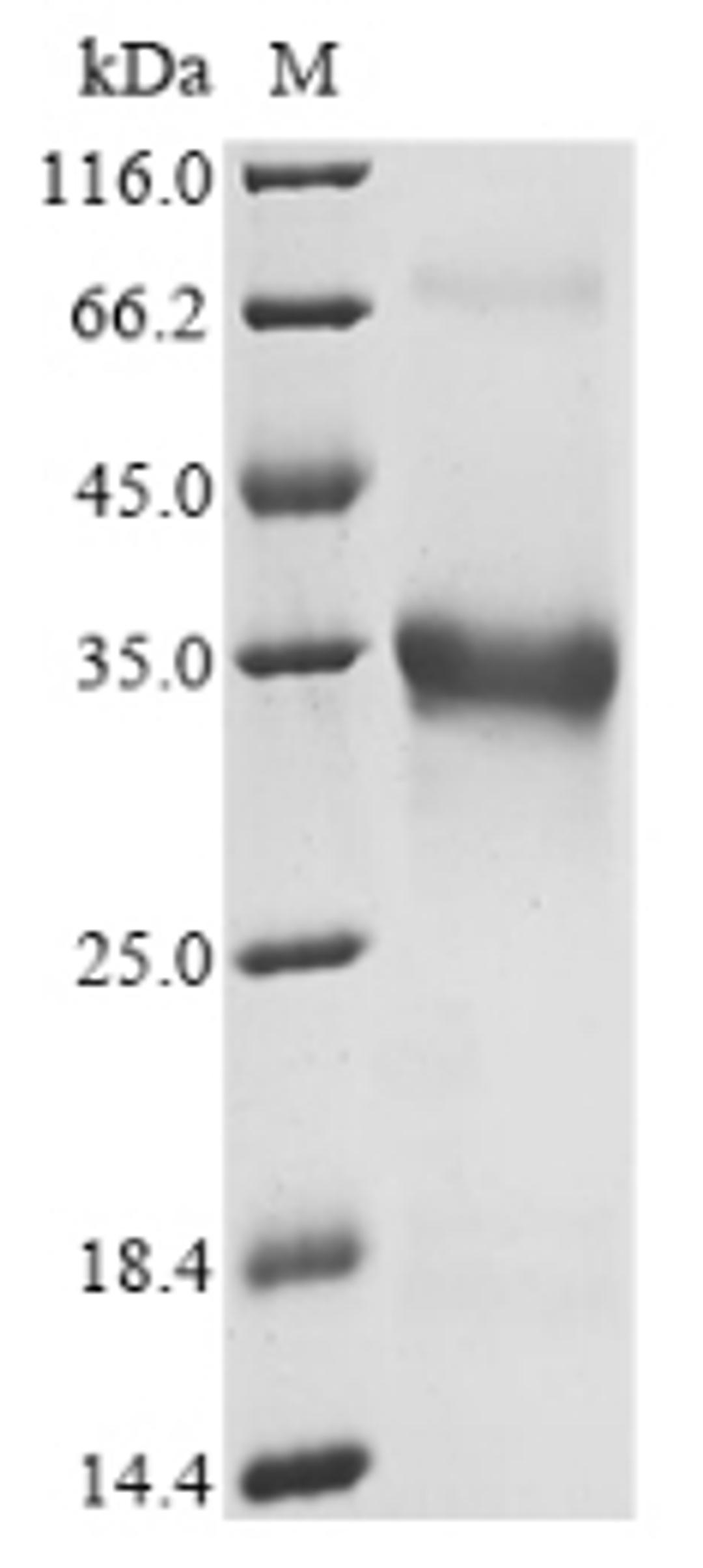 (Tris-Glycine gel) Discontinuous SDS-PAGE (reduced) with 5% enrichment gel and 15% separation gel.