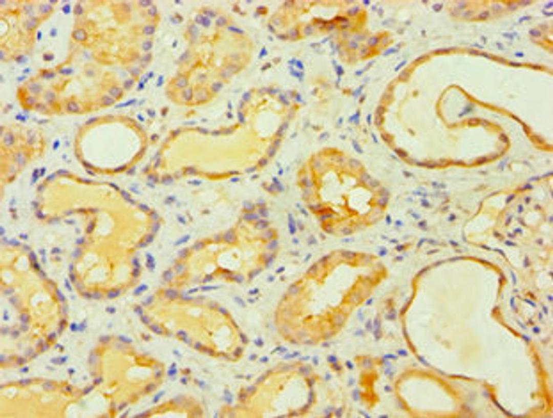 Immunohistochemistry of paraffin-embedded human kidney tissue using CSB-PA839866DSR2HU at dilution of 1:100