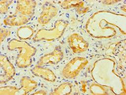 Immunohistochemistry of paraffin-embedded human kidney tissue using CSB-PA839866DSR2HU at dilution of 1:100
