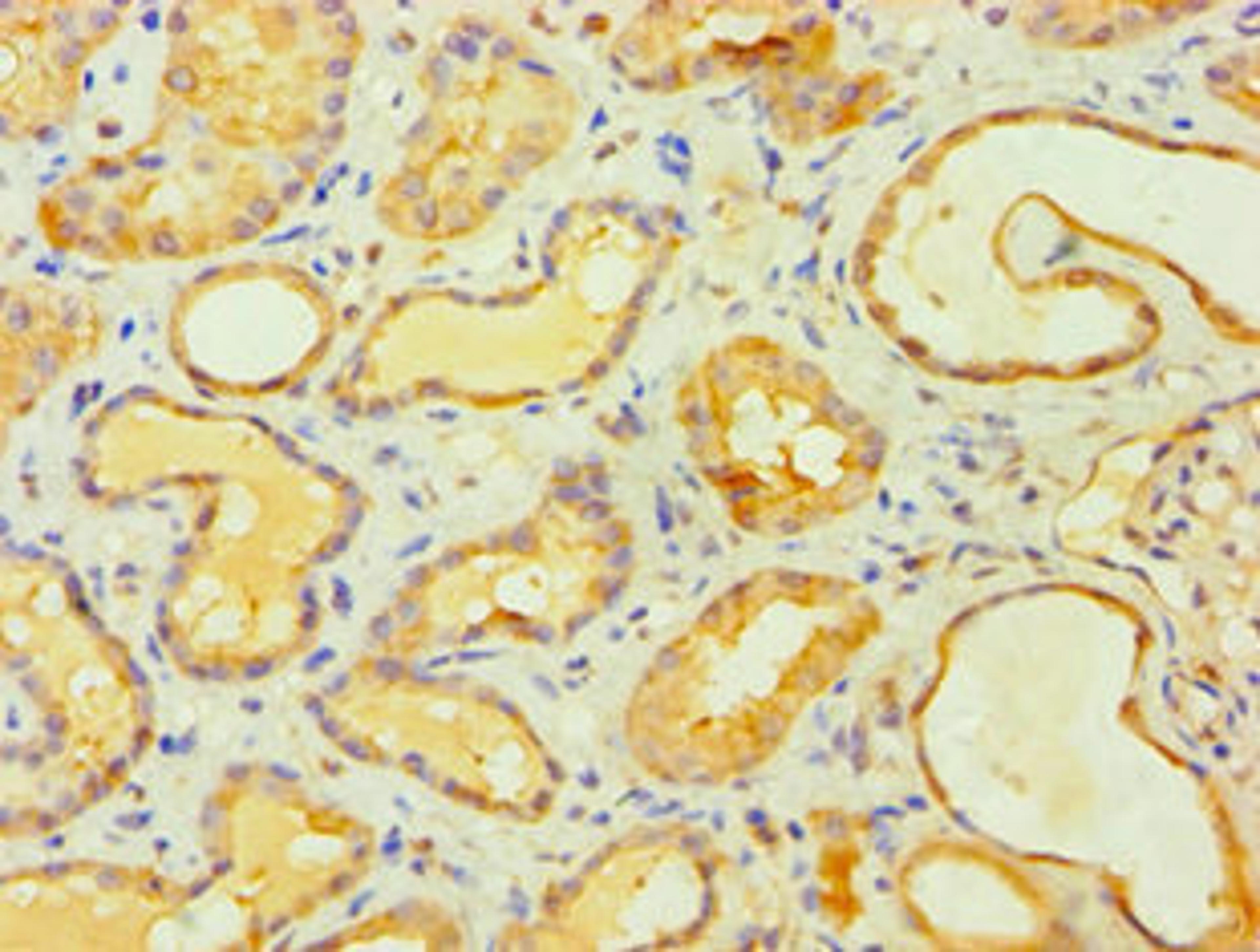 Immunohistochemistry of paraffin-embedded human kidney tissue using CSB-PA839866DSR2HU at dilution of 1:100