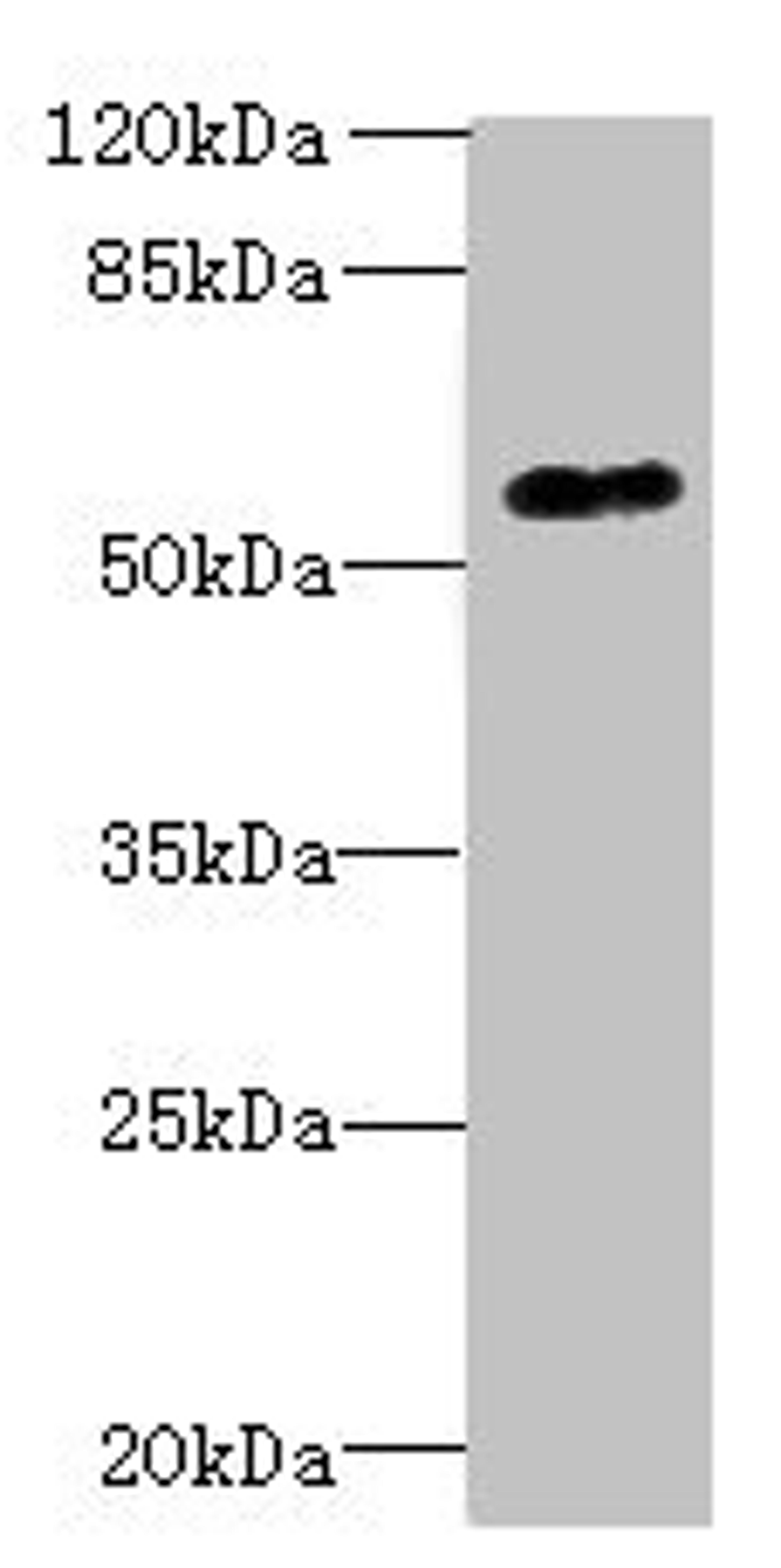 Western blot. All lanes: GPR176 antibody at 10µg/ml + A431 whole cell lysate. Secondary. Goat polyclonal to rabbit IgG at 1/10000 dilution. Predicted band size: 57, 53 kDa. Observed band size: 57 kDa