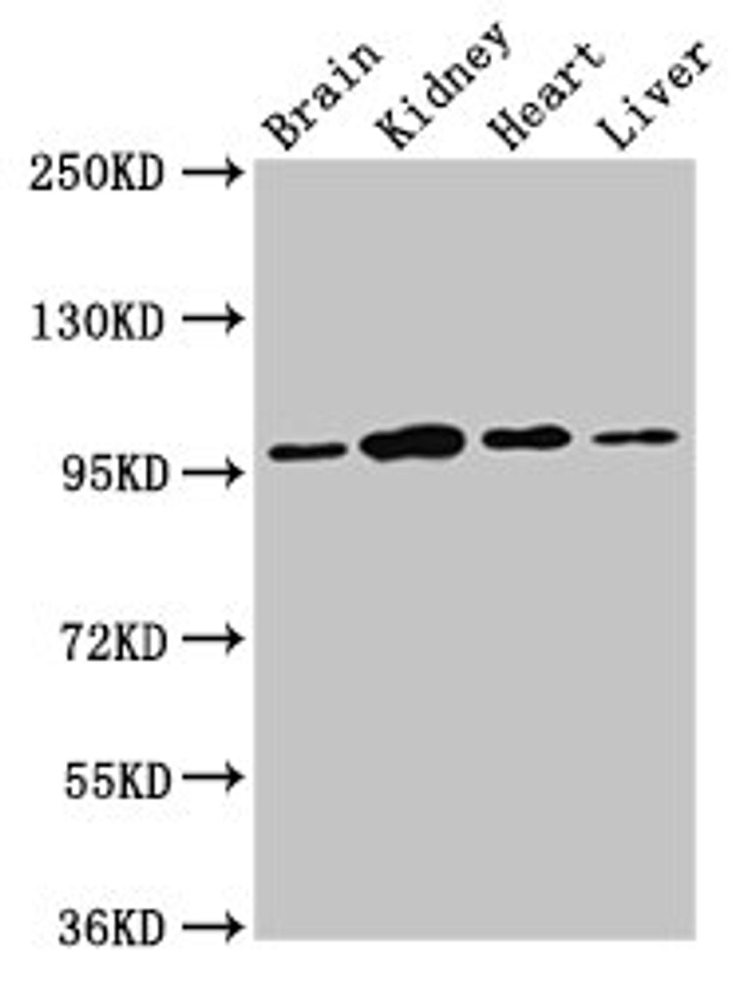 Western Blot. Positive WB detected in: Rat brain tissue, Rat kidney tissue, Mouse heart tissue, Mouse liver tissue. All lanes: NAA15 antibody at 3ug/ml. Secondary. Goat polyclonal to rabbit IgG at 1/50000 dilution. Predicted band size: 102, 62 kDa. Observed band size: 95 kDa. 