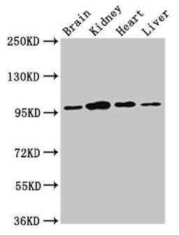 Western Blot. Positive WB detected in: Rat brain tissue, Rat kidney tissue, Mouse heart tissue, Mouse liver tissue. All lanes: NAA15 antibody at 3ug/ml. Secondary. Goat polyclonal to rabbit IgG at 1/50000 dilution. Predicted band size: 102, 62 kDa. Observed band size: 95 kDa. 