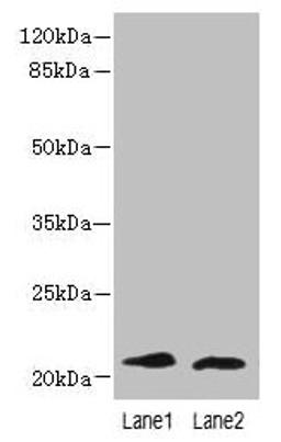 Western blot. All lanes: LRRC20 antibody at 1µg/ml. Lane 1: Jurkat whole cell lysate. Lane 2: Mouse spleen tissue. Secondary. Goat polyclonal to rabbit IgG at 1/10000 dilution. Predicted band size: 21, 15 kDa. Observed band size: 21 kDa