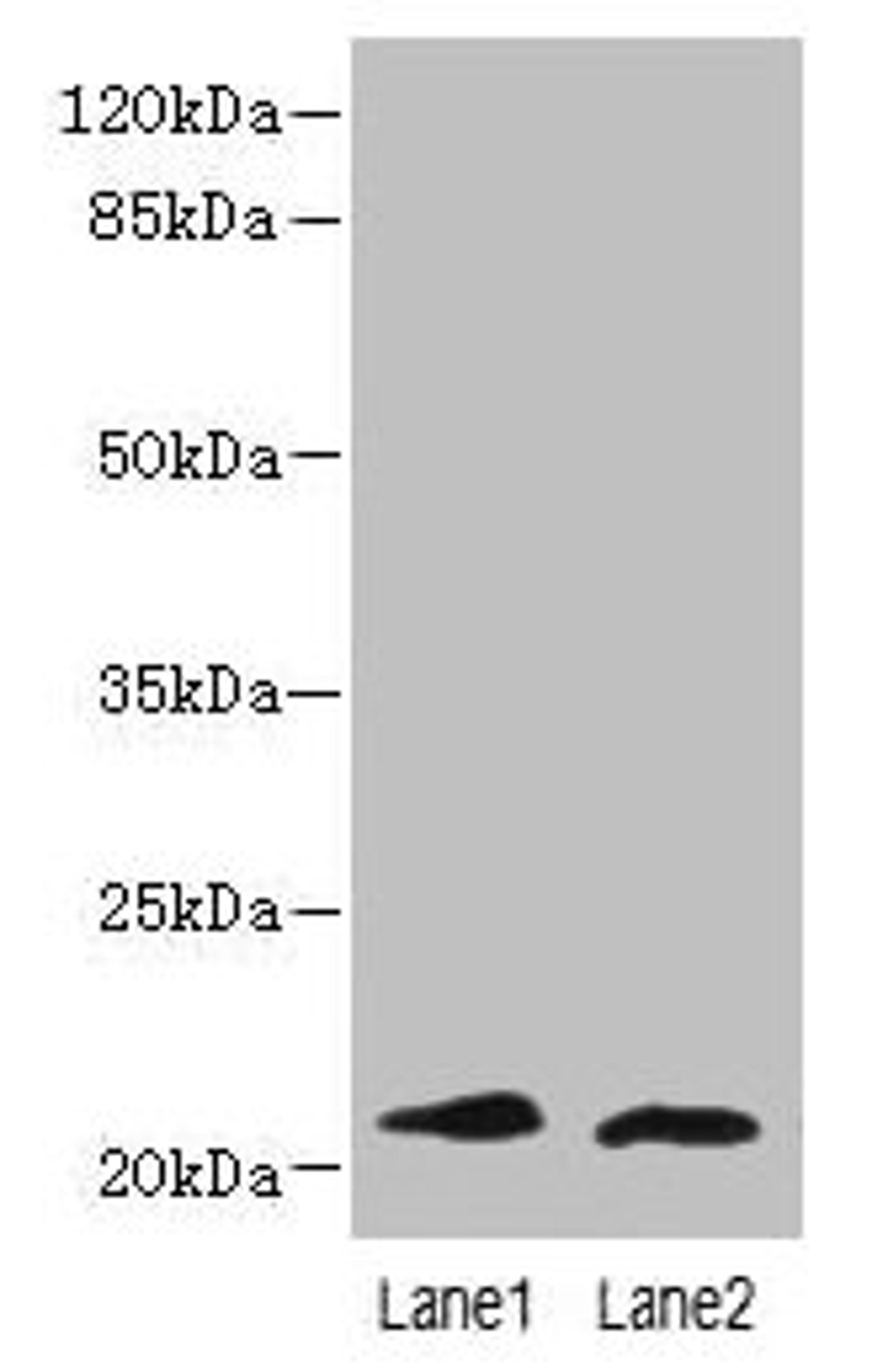 Western blot. All lanes: LRRC20 antibody at 1µg/ml. Lane 1: Jurkat whole cell lysate. Lane 2: Mouse spleen tissue. Secondary. Goat polyclonal to rabbit IgG at 1/10000 dilution. Predicted band size: 21, 15 kDa. Observed band size: 21 kDa