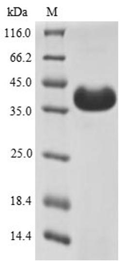 (Tris-Glycine gel) Discontinuous SDS-PAGE (reduced) with 5% enrichment gel and 15% separation gel.
