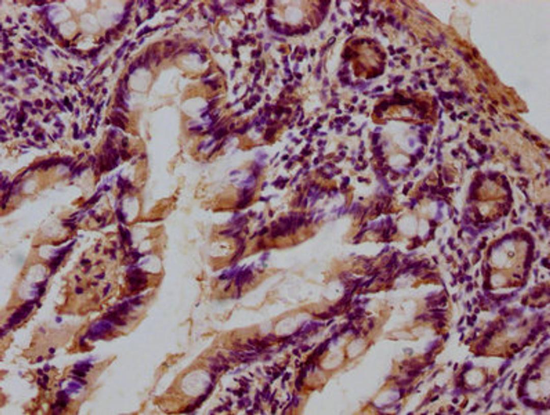 IHC image of CSB-PA012889LA01HU diluted at 1:100 and staining in paraffin-embedded human small intestine tissue performed on a Leica BondTM system. After dewaxing and hydration, antigen retrieval was mediated by high pressure in a citrate buffer (pH 6.0). Section was blocked with 10% normal goat serum 30min at RT. Then primary antibody (1% BSA) was incubated at 4°C overnight. The primary is detected by a biotinylated secondary antibody and visualized using an HRP conjugated SP system.