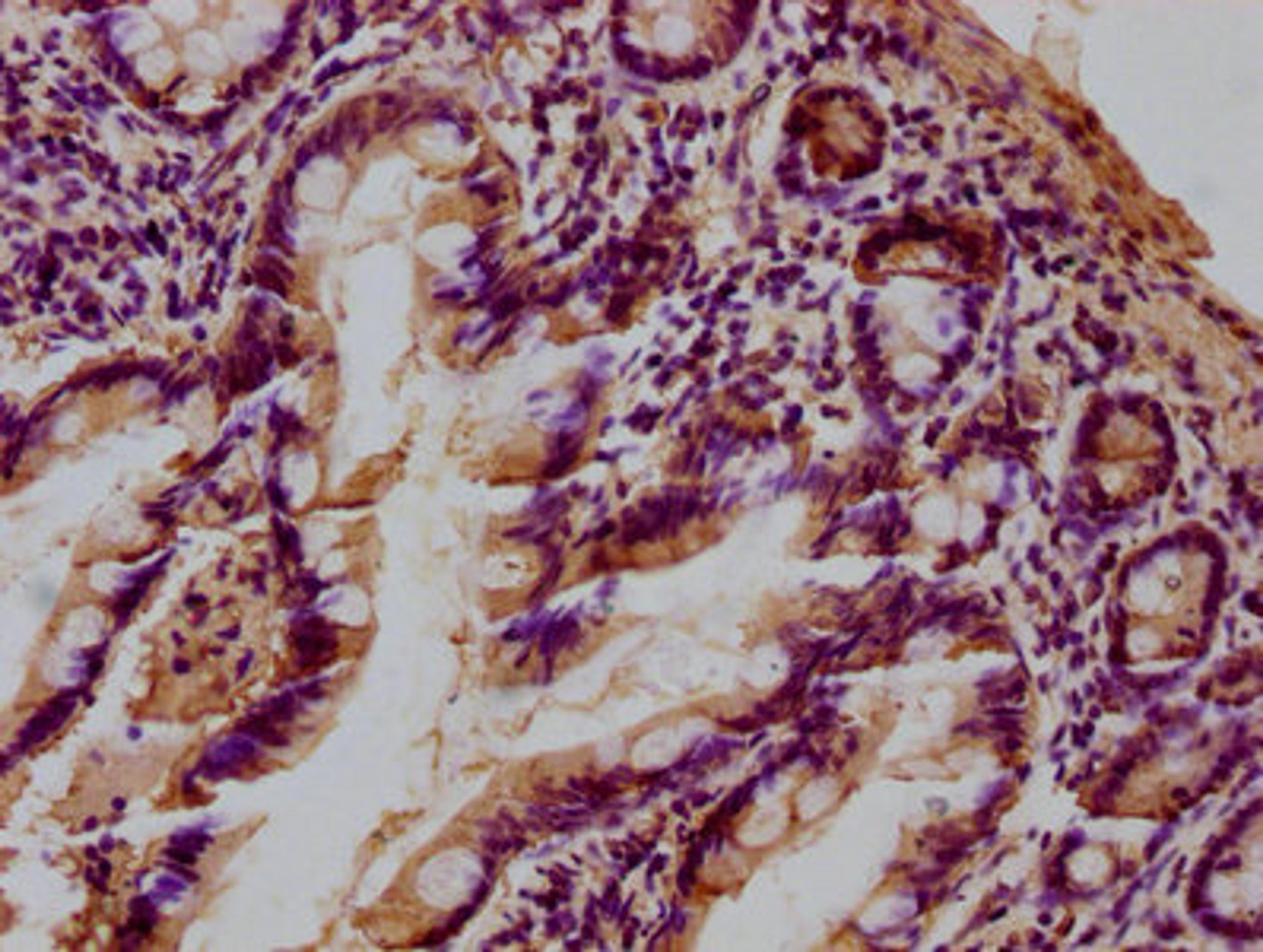 IHC image of CSB-PA012889LA01HU diluted at 1:100 and staining in paraffin-embedded human small intestine tissue performed on a Leica BondTM system. After dewaxing and hydration, antigen retrieval was mediated by high pressure in a citrate buffer (pH 6.0). Section was blocked with 10% normal goat serum 30min at RT. Then primary antibody (1% BSA) was incubated at 4°C overnight. The primary is detected by a biotinylated secondary antibody and visualized using an HRP conjugated SP system.