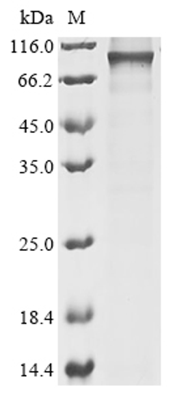 (Tris-Glycine gel) Discontinuous SDS-PAGE (reduced) with 5% enrichment gel and 15% separation gel.