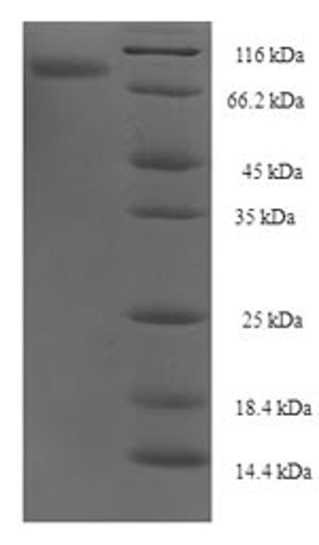 (Tris-Glycine gel) Discontinuous SDS-PAGE (reduced) with 5% enrichment gel and 15% separation gel.